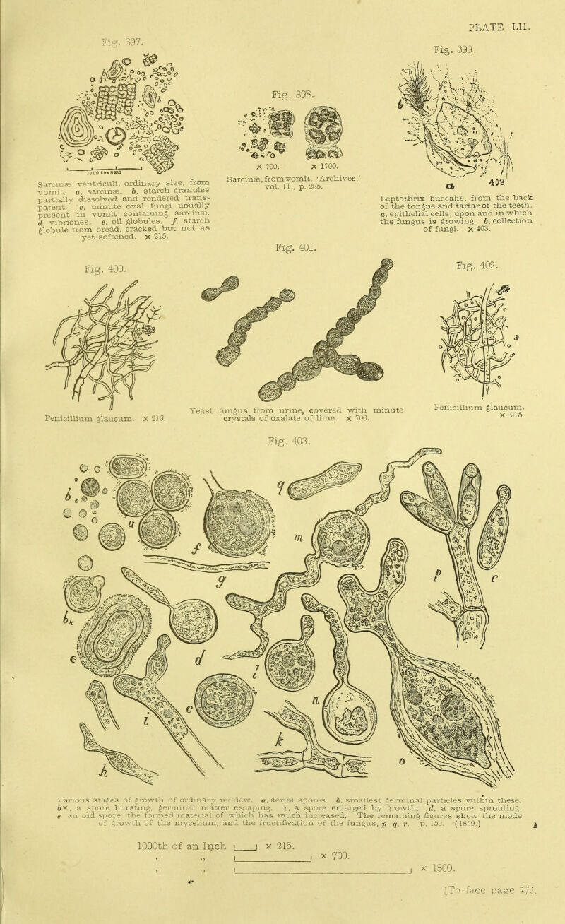 397. Fig. 393. Sarcmee ventriculi, ordinary size, from vomit, a, sarcinaa. b, starcti grannies partially dissolved and rendered trans- parent, c, minute oval fungi us-vially present in vomit containing sarcinte. d, vibnones. e, oil globules. /, atarcli globule from bread, cracked but not as yet softened. X 315. X 1700.. Sarcin^, from vomit. 'Archives, vol. TI., p. 285. Fig. 401. PLATE LII. Fic. 393. Leptothrix buccalis, from the back of the tongue and tartar of the teeth. a, epithelial cells, upon and in which the fungus is growing, b, collection of fungi. X 403. Fig. 402. Penicillium glaucum. X 315. Yeast fungus from urine, covered with minute crystals of oxalate of lime, x TOO. Penicillium glaucum. X 215. Fig. 403. Various stages of growth of ordinary ii>il'l.-\T. a, aerial spores. b>. smallest germinal particles wiLhin these. I)X, H spore bursting, gemiinal rnatier tscaijing. c, a spore enlarged by growth, d. a spore sprouting. e an old spoi-e the formed material of wlm h Ijas much increased. The remaining figures sbow the mode of growth of the mycelium, and the fructification of the fungus,^, q, r. p. i5J. (IS.'Q.) j 1000th of an Inch J X -215. X 700. X 13G0.