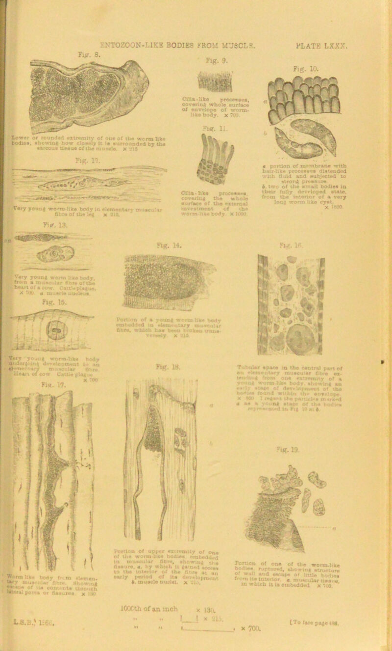 Fig. 8. lo-w-i or rcundsd .xtmraity of one of the worm Uk* bodiei, abcwlnft how clo.ely ft 1* eurroitidrd by Ihe utcoue tire je of the rnu.cl. x J15 Fit?. 11. Very yeunj wom like body In dmeoUrt mo*cu:.tr fibre of the >$ x 3lfi. Fitf. 13. Fig. 9. Cilia-like processes, covering whole surface ol vnvrlope of worm- like body. x ?<IV). “ie. li. Cilia-like process-* covering tbe whole surface of the external mveetmwnt cf .b* worm like body X UW Fig. 10. a portion of membrane with hair-like processes distended with fluid and subjected to strong pressure 6. two of die small bodies in their fully devrloped state, from the interior of a very long worm Uke cyst. X »K» gVe V yonn4 worm h..body, \\ from a muscular fibre of the heart of a cow. Cattlepla; uj. X T«JU e muerle nucleus. Fig. 15. Very yojiljl worm-like body under 4 ing development in ati dle»n«r.r*rr muscular flbr* ,* Hears. of cow Cathe ptag x 00 Fi*. 17. Wriren like body frt m «l*tnen. *7 muscular fl> •. fihowmi Jkcape of its conf ute through posts or fissures x 130 Fig. 14. Portion of a young worm Wke body rmtedi^d tu »*letr. ntary muicu'ir fibre, which Lae been ■ roken trail* r*»rs«ly X *11 Fig. 13. Portion of upper extremity of one of tbe worm-like bodies embedded in muscular fibr*, sbov.-.n; fissure, a. by which it gamed access to the interior ot the fibre »t an early period of ita dev-iopm-ir. 6. muscle nuclei, x Ul.. fUt4 lfi. Tubular space m tbe central part of an elementary muscular fibre m t- in; fiorn One ~ tt remit v of h ug * -m like body, ebowirg an • •» 1 y stake o! dev*liuni«ut of the *x • ffotnvi wrhita th envelope X 90U T the peru«>s invkrg a an a young stage of ? be r odUw repr*Nr nu*d In Pig 10 as t ~ig. 19. lOOCth of an inch x I3i/. •• •• I I * 2D. M ... X 700. *1 L.