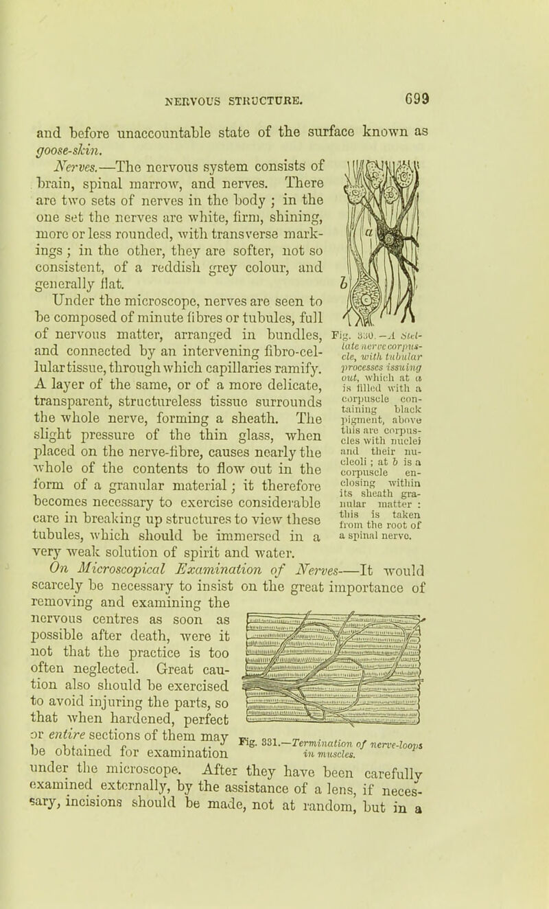 and iDefore unaccountable state of the surface known as goose-skin. Nerves.—The nervous system consists of hrain, spinal marrow, and nerves. There are two sets of nerves in the Lody ; in the one set the nerves are wliite, firn), shining, more or less rounded, with transverse mark- ings ; in the other, they are softer, not so consistent, of a reddish grey colour, and generally flat. Under the microscope, nerves are seen to he composed of minute fibres or tubules, full of nervous matter, arranged in bundles, and connected by an intervening fibro-cel- lular tissue, through which capillaries ramify. A layer of the same, or of a more delicate, transparent, structureless tissue surrounds the whole nerve, forming a sheath. The slight pressure of the thin glass, when placed on the nerve-fibre, causes nearly the Avhole of the contents to flow out in the form of a granular material; it therefore becomes necessary to exercise considei-able care in breaking up structures to view these tubules, which should be immersed in a very Aveak solution of spirit and water. On Microscopical Examination of Nerves—It would scarcely be necessary to insist on the great importance of removing and examining the nervous centres as soon as possible after death, were it not that the practice is too often neglected. Great cau- tion aLso should be exercised to avoid injuring the parts, so that when hardened, perfect or entire sections of them may be obtained for examination under the microscope. After they have been carefully examined externally, by the assistance of a lens, if neces- sary, incisions should be made, not at random, but in a Fig. 'AM. - A 6l.d- late iiervccorims- cle, with tabular processes issiting Old, whw.h at a is iilhul with a coriiuscle con- taining black ]>igment, above tliis arc corpus- cles with miclei und their nu- cleoli ; at 6 is a coi-puscle en- closing within its sheath gra- nular matter : this is taken from the root of a spinal nervo. Pig. 3Z1.—Termination of nerve-loops ill muscles.