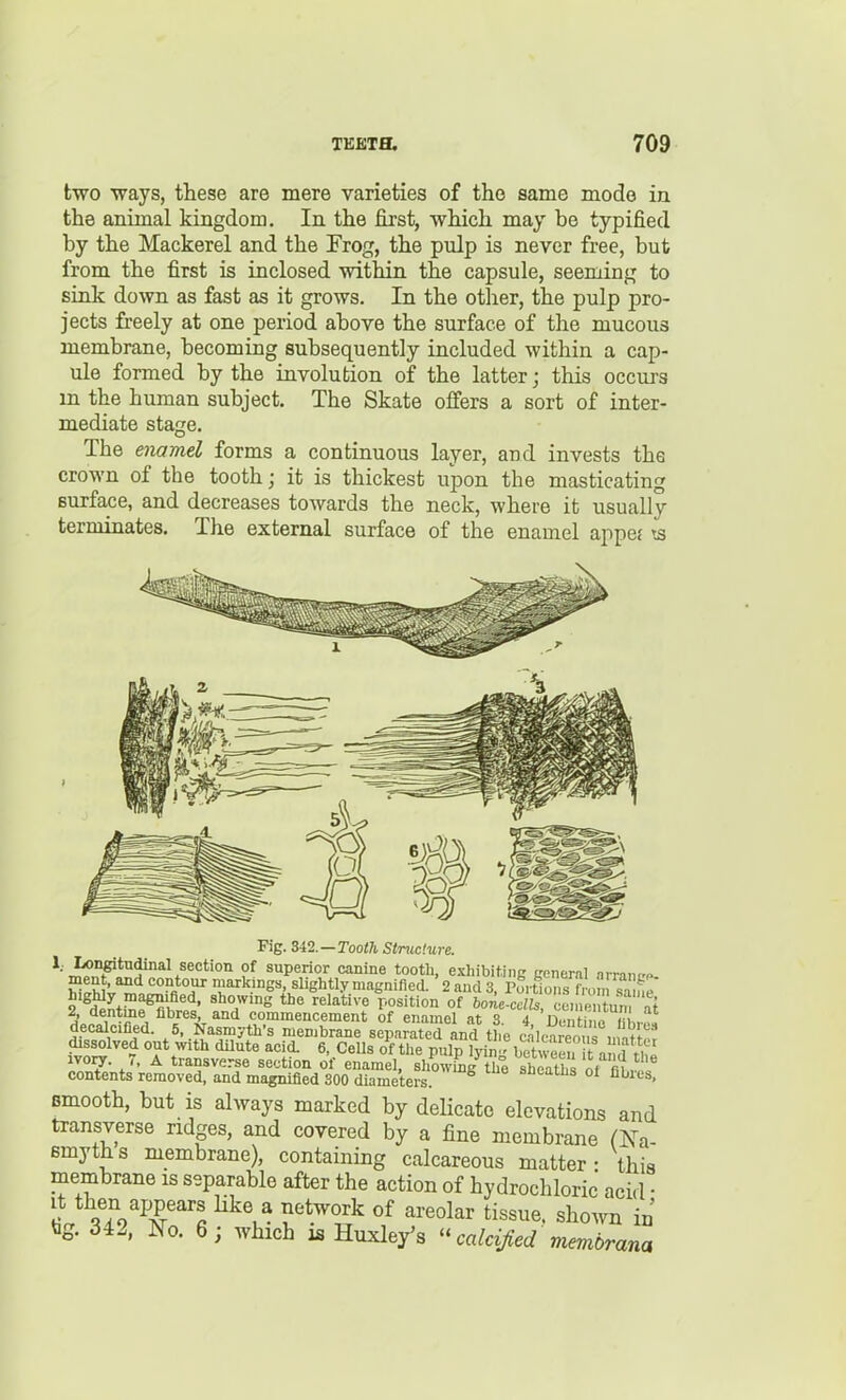 two ways, these are mere varieties of the same mode in the animal kingdom. In the first, which may be typified by the Mackerel and the Frog, the pulp is never free, but from the first is inclosed within the capsule, seeming to sink down as fast as it grows. In the other, the pulp pro- jects freely at one period above the surface of the mucous membrane, becoming subsequently included within a cap- ule formed by the involution of the latter; this occurs m the human subject. The Skate offers a sort of inter- mediate stage. The enamel forms a continuous layer, and invests the crown of the tooth; it is thickest upon the masticating surface, and decreases towards the neck, where it usually terminates. The external surface of the enamel appe.- ts Pig. Tooth Structure. I^^P^'^f'^^'l ^s^<iiion of superior canine tooth, exliibiting genernl arranr-P- ment, and contour markings, sliglitly magnified. 2 and 3, Turtions from Tame 2^d^^t,^Mfi' r-osition of 6one-cc/i. en e ?um at A dentine fibres, and commencement of enamel .it. q d ii,.r,f;,,., i i de^cified. 5..Nasmyth-s membrane separTed and the '^i™ dissolved out with dilute acid. 6, CeUs of the pulp lyin- bi^tween t ! 1V0I7. 7, A transverse section of enamel, showL'th°e shrths of n^' - contents removed, and magnified 300 diameters. sneaihs ol fibres, smooth, but is always marked by delicate elevations and transverse ndges, and covered by a fine membrane (Na- emyths membrane), containing calcareous matter- this membrane is separable after the action of hydrochloric acid • ^To^'^r^'^ ^''^'^^'^ ^^'^^^^^ tissue. shoAvn in' bg. 342. No. 6; which is Huxley's calcijied membrana