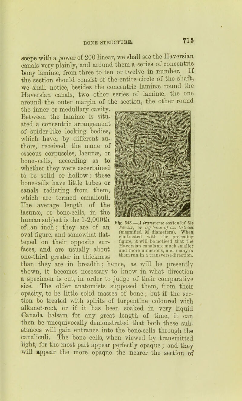 716 flcsope -with a power of 200 linear, we shall see the Haversian canals very plainly, and around them a series of concentric bony lamina?, from three to ten or twelve in nuniher. If the section should consist of the entire circle of the shaft, we shall notice, besides the concentric laminaj round the Haversian canals, two other series of lamina?, the one around the outer margin of the section, the other round the inner or medullary cavity. Between the lamina? is situ- ated a concentric arrangement of spider-like looking bodies, which have, by different au- thors, received the name of osseous corpuscles, lacunae, or bone-cells, according as to whether they were ascertained to be solid or hollow: these bone-cells have little tubes or canals radiating from them, which are termed canaliculi. The average length of the lacunae, or bone-cells, in the human subject is the l-2,000th ^^g. ,,s.-A transverse scctionW m of an inch J they are of an Femur, or leg-bone of an Ostrich. oval figure, and somewhat flat- tened on their opposite sur- faces, and are usually about one-third greater in thickness than they are in breadth; hence, as wiU be j)resently shown, it becomes necessary to know in what direction a specimen is cut, in order to judge of their comparative size. The older anatomists supposed them, from their opacity, to be little solid masses of bone; but if the sec- tion be treated with spirits of turpentine coloured with alkanet-rcob, or if it has been soaked in very liquid Canada balsam for any great length of time, it can then be unequivocally demonstrated that both these sub- stances will gain entrance into the bone-cells through the canaliculi. The bone cells, when viewed by transmitted light, for the most part appear perfectly opaque ; and they will appear the more opaque the nearer the section of (magnified 95 diameters). When contrasted with tlie preceding figure, it will be noticed tiiat tlia Haversian canals are much smaller and more numerous, and many Oi them run in a transvei'sedirectioiL