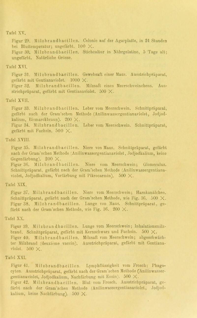 Figur 20, Milzbrandbacillen. Colonie auf der Agarplatte, in 2-1 Stunden bei Blutteuiporatur; ungefärbt. 100 X. Figur 30. Milzbrandbacillen. Stichcultur in Xiihrgolatino, 5'Tage alt; ungefärbt. Xatürliohe Grösse. Tafel XVI. Figur 31. Milzbrandbacillen. Ge\\'obsaft einer Maus. Ausstrichpräparat, gefärbt mit Gentianaviolet. 1000 X- Figur 32. Milzbrandbacillen. Milzsaft eines Meerschweinchens. Aus- strichpräparat, gefärbt mit Gentianaviolet. 500 X- Tafel XVII. Figur 33. Milzbrandbacillen. Leber vom Meerschwein. Schnittpräparal, gefärbt nach der Gram’schen Methode (Anilinwassergentianaviolet, Jodjod- kalium, Bismarckbraun). 200 X. Figur 34. Milzbrandbacillen. Leber vom Meerschwein. Schnittpräparat, gefärbt mit Fuchsin. 500 X. Tafel XVIII. Figur 35, Milzbrandbacillen. Niere von Maus, Schnittpräparat, gefärbt nach der Gram’schen Methode (Anilinwassergentianaviolet, Jodjodkalium, keine Gegenfärbung). 200 X. Figur 36. Milzbrandbacillen. Niere vom Meerschwein; Glomerulus. Schnittpräparat, gefärbt nach der Gram’schen Methode (Anilinwassergentiana- violet, Jodjodkalium, Vorfärbung mit Pikrocarmin). 500 X. Tafel XIX. Figur 37. Milzbrandbacillen. Niere vom Meerschwein; Harnkanälchen. Schnittpräparat, gefärbt nach der Gram’schen Methode, wie Fig. 36. 500 X. Figur 38. Milzbrandbacillen. Lunge von Maus. Schnittpräparat, ge- färbt nach der Gram’schen Methode, wie Fig. 36. 200 X- Tafel XX. Figur 39. Milzbrandbacillen. Lunge vom Meerschwein; Inhalationsmilz- brand. Schnittpräparat, gefärbt mit Kernschwarz und Fuchsin. 500 X. Figur 40. Milzbrandbacillen. Milzsaft vom Meerschwein; abgeschwäch- ter Milzbrand (deuxiöme vaccin), Ausstrichpräparat, gefärbt mit Gentiana- violet. 500 X. Tafel XXL Figur 41. Milzbrandbacillcn. Lymphllüssigkeit vom Frosch; Phago- cyten. Ausstrichpräparat, gefärbt nach der Gram’schen Methode ^Anilinwasser- gentianaviolet, Jodjodkalium, Nachfärbung mit Eosin). 500 X. Figur 42. Milzbrandbacillen. Blut vom Frosch. Ausstrichpräparat, ge- färbt nach der Gram’schen Methode (Anilinwassergentianaviolet, Jodjod- kalium, keine Nachfärbung). 500 X.