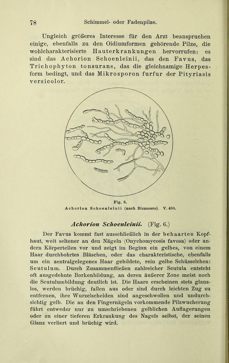 Ungleich größeres Interesse für den Arzt beanspruchen einige, ebenfalls zu den Oidiumformen gehörende Pilze, die wohl charakterisierte Hauterkrankungen hervorrufen: es sind das Achorion Schoenleinii, das den Favus, das Trichophyton tonsurans, das die gleichnamige Herpes- form bedingt, und das Mikrosporon furfur der Pityriasis versicolor. Fig. 6. Achorion Schoenleinii (nach Bizzozero). V. 400. Achorion Schoenleinii. (Fig. 6.) Der Favus kommt fast ausschließlich in der behaarten Kopf- haut, weit seltener an den Nägeln (Onychomycosis favosa) oder an- dern Körperteilen vor und zeigt im Beginn ein gelbes, von einem Haar durchbohrtes Bläschen, oder das charakteristische, ebenfalls um ein zentralgelegenes Haar gebildete, rein gelbe Schüsselchen: Scutulum. Durch Zusammenfließen zahlreicher Scutula entsteht oft ausgedehnte Borkenbildung, an deren äußerer Zone meist noch die Scutulumbildung deutlich ist. Die Haare erscheinen stets glanz- los, werden brüchig, fallen aus oder sind durch leichten Zug zu entfernen, ihre Wurzelscheiden sind angeschwollen und undurch- sichtig gelb. Die an den Fingernägeln vorkommende Pilzwucherung führt entweder nur zu umschriebenen gelblichen Auflagerungen oder zu einer tieferen Erkrankung des Nagels selbst, der seinen Glanz verliert und brüchig wird.