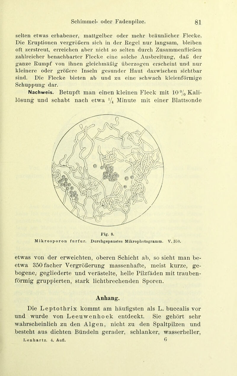 selten etwas erhabener, mattgelber oder mehr bräunlicher Flecke. Die Eruptionen vergrößern sich in der Regel nur langsam, bleiben oft zerstreut, erreichen aber nicht so selten durch Zusammenfließen zahlreicher benachbarter Flecke eine solche Ausbreitung, daß der ganze Rumpf von ihnen gleichmäßig überzogen erscheint und nur kleinere oder größere Inseln gesunder Haut dazwischen sichtbar sind. Die Flecke bieten ab und zu eine schwach kleienförmige Schuppung dar. Nachweis. Betupft man einen kleinen Fleck mit 10% Kali lösung und schabt nach etwa 1/i Minute mit einer Blattsonde Fig. 8. Mikrosporon furfur. Durchgepaustes Mikrophotogramm. V. 3Ö0. etwas von der erweichten, oberen Schicht ab, so sieht man be- etwa 350 facher Vergrößerung massenhafte, meist kurze, ge- bogene,- gegliederte und verästelte, helle Pilzfaden mit trauben- förmig gruppierten, stark lichtbrechenden Sporen. Anhang. Die Leptothrix kommt am häufigsten als L. buccalis vor und wurde von Leeuwenlioek entdeckt. Sie gehört sehr wahrscheinlich zu den Algen, nicht zu den Spaltpilzen und besteht aus dichten Bündeln gerader, schlanker, wasseidieller, Lenhartz. i. Aufl. b