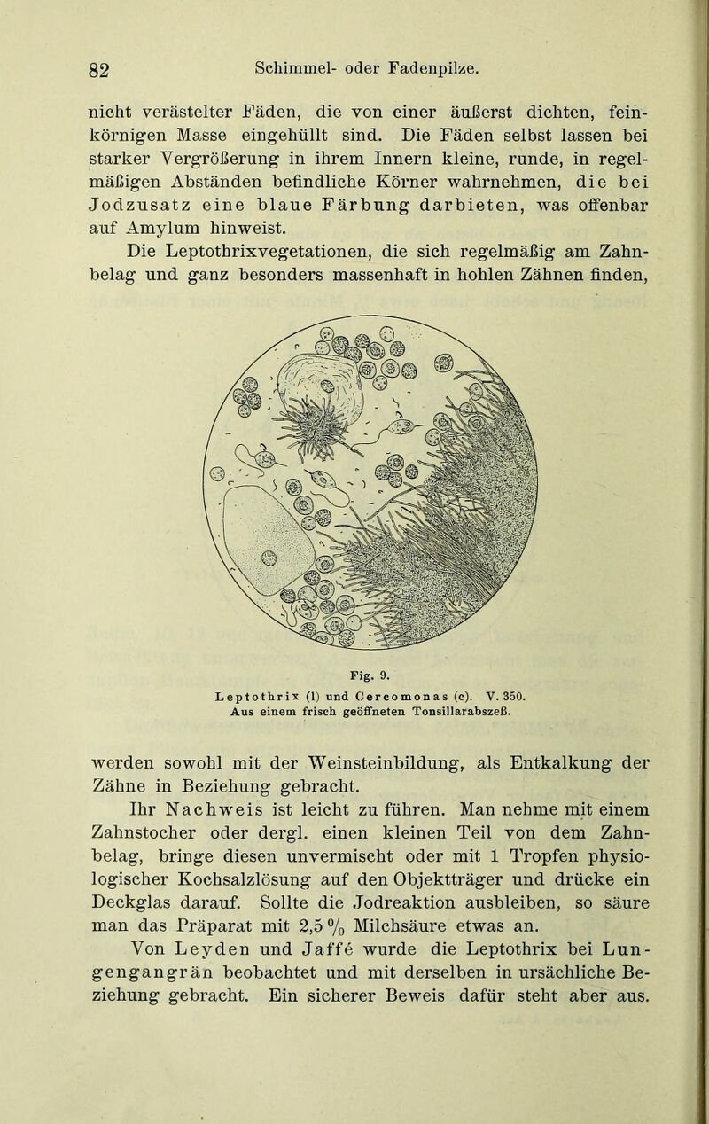 nicht verästelter Fäden, die von einer äußerst dichten, fein- körnigen Masse eingehüllt sind. Die Fäden selbst lassen bei starker Vergrößerung in ihrem Innern kleine, runde, in regel- mäßigen Abständen befindliche Körner wahrnehmen, die bei Jodzusatz eine blaue Färbung darbieten, was offenbar auf Amylum hinweist. Die Leptothrixvegetationen, die sich regelmäßig am Zahn- belag und ganz besonders massenhaft in hohlen Zähnen finden, Fig. 9. Leptothrix (1) und Oercomonas (c). V. 350. Aus einem frisch geöffneten Tonsillarabszeß. werden sowohl mit der Weinsteinbildung, als Entkalkung der Zähne in Beziehung gebracht. Ihr Nachweis ist leicht zu führen. Man nehme mit einem Zahnstocher oder dergl. einen kleinen Teil von dem Zahn- belag, bringe diesen unvermischt oder mit 1 Tropfen physio- logischer Kochsalzlösung auf den Objektträger und drücke ein Deckglas darauf. Sollte die Jodreaktion ausbleiben, so säure man das Präparat mit 2,5 % Milchsäure etwas an. Von Leyden und Jaffe wurde die Leptothrix bei Lun- gengangrän beobachtet und mit derselben in ursächliche Be- ziehung gebracht. Ein sicherer Beweis dafür steht aber aus.