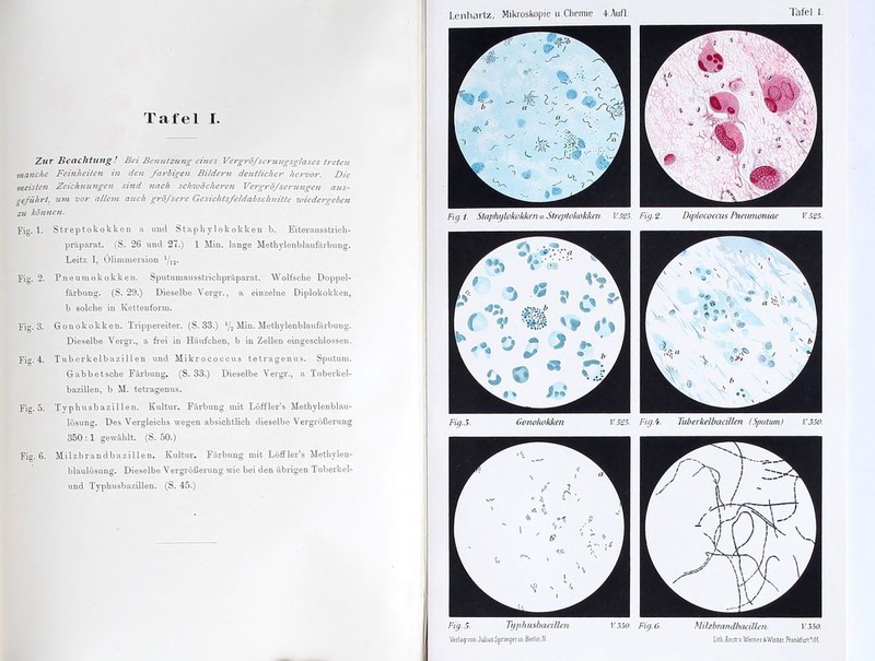 Zur Beachtung! Bei Benutzung eines Vergröfscrungsglases treten manche Feinheiten in den farbigen Bildern deutlicher hervor. Die meisten Zeichnungen sind nach schwächeren Vergröfserungen aus- geführt, um vor allem auch gröfsere Gesichtsfeldabschnitte wiedergeben sii können. Fig. 1. Streptokokken a und Staphylokokken b. Eiterausstrich- präparat. (S. 26 und 27.) 1 Min. lange Methylonblaufärbung. Leitz I, Ölimmersion l/vl. Fio-, 2. Pneumokokken. Sputumausstrichpräparat. Wolfsclie Doppel- farbung. (S. 29.) Dieselbe Vergr., a einzelne Diplokokken, b solche in Kettenform. Fier. 3. Gonokokken. Trippereiter. (S. 33.) */n Min. Methylenblaufärbung. Dieselbe Vergr., a frei in Häufchen, b in Zellen eingeschlossen. Fig. 4. Tnberkelbazillen und Mikrococcus tetragenus. Sputum. Gabbetsche Färbung. (S. 33.) Dieselbe Vergr., a Tuberkel- bazillen, b M. tetragenus. Fia. 5. Typhusbazillen. Kultur. Färbung mit Löffler’s Methylenblau- lösung. Des Vergleichs wegen absichtlich dieselbe Vergrößerung 350 :1 gewählt. (S. 50.) Fig. 6. Milzbrandbazillen. Kultur. Färbung mit Löffler’s Methylen- blaulösung. Dieselbe Vergrößerung wie bei den übrigen Tuberkel- und Typhusbazillen. (S. 45.) Lenhartz, Mikroskopie u.Chemie +.Aufl. Tafel l. Fig./. Staphylokokken u.Streptokokhen V.525. Fig.2. DiplococcusPneumoniae V525. Fig.3. Gonokokken V.525. Fig.4-. Tuberkelbacillen (Sputum) V.350. Fig.5. Typhusbacillen v.350. Fig.6. MilzbrandbaciUcrv V.350. Verlag von Julius Springerin Berlin N lilh.Anst.v.Werner4Wmter,lTankfurt11/M.