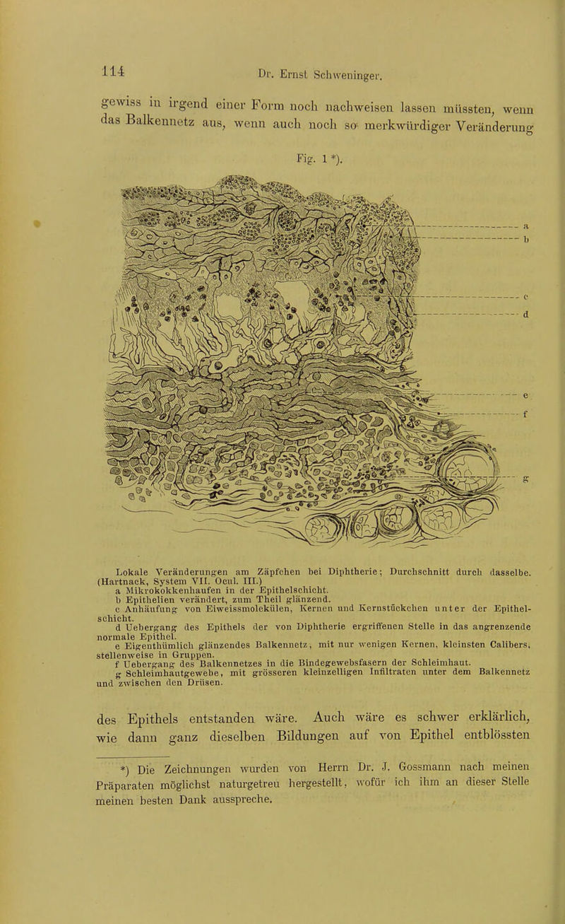 gewiss iu irgend einer Form noch nachweisen lassen müssten, wenn das Balkennetz aus, wenn auch noch so merkwürdiger Veränderung Fi-. 1 *). N^^iflifc^i 'M'-^^s, '^^,w-:~^iw ' '^HjfetÄk^^ m ' Lokale Veränderungen am Zäpfchen bei Diphtherie; Durchschnitt durch dasselbe. (Hartnacls, System VII. Ocul. III.) a Milivoltolikenliaufen in der Epithelscliicht. b Epithelien verändert, zum Theil glänzend. c Anhäufung von Eivreissmolekülen, Kernen und Kernstückchen unter der Epithel- schicht. d Uebergang des Epithels der von Diplitherie ergriffenen Stelle in das angrenzende normale Epithel. e Eigenthümlicli glänzendes Balkennetz, mit nur wenigen Kernen, kleinsten Calibers, stellenweise in Gruppen. f Uebergang des Balkennetzes in die Bindegewebsfasern der Schleimhaut. g Schleimhautgewebe, mit grösseren kleinzelligen Infiltraten unter dem Balkennetz und zwischen den Drüsen. des Epithels entstanden wäre. Auch wäre es schwer erklärlich, wie dann ganz dieselben Bildungen auf von Epithel entblössten *) Die Zeichnungen wui'den von Herrn Dr. J. Gossmann nach meinen Präparaten möglichst naturgetreu hergestellt, wofür ich ihm an dieser Stelle meinen besten Dank ausspreche.