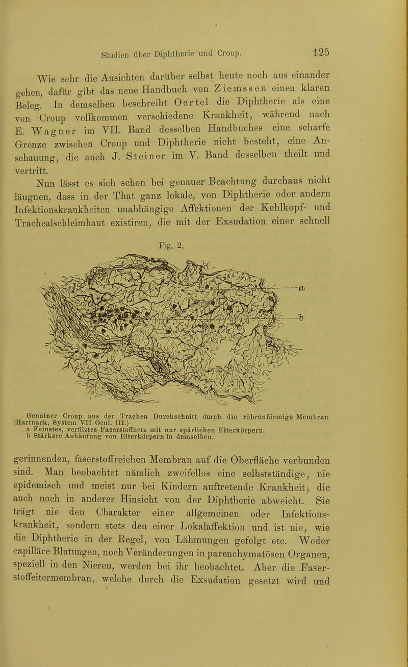 Wie sehr die Ansichten darüber selbst heute noch aus einander gehen, dafür gibt das neue Handbuch von Ziemssen einen klaren Beleg! In demselben beschreibt Oertel die Diphtherie als eine von Croup vollkommen verschiedene Krankheit, während nach E. Wagner im VII. Band desselben Handbuches eine scharfe Grenze zwischen Croup und Diphtherie nicht besteht, eine An- schauung, die auch J. Steiner im V. Band desselben theilt und vertritt. Nun lässt es sich schon bei genauer Beachtung durchaus nicht läugnen, dass in der That ganz lokale, von Diphtherie oder andern Infektionskrankheiten unabhängige AfFektionen der Kehlkopf- und Tracheaischleimhaut existiren, die mit der Exsudation einer schnell Fig. 2. Genuiner Croup aus der Trachea Durchschnitt durch die röhrenförmige Membran (Hartnaclc, System VII Ocul. III.) a Feinstes, vcrfliztes Faserstofifnetz mit nur spärlichen Eiterkörpern, b Stärkere Anhäufung von Eiterkörpern in demsell)en. gerinnenden, faserstoffreichen Membran auf die Oberfläche verbunden sind. Man beobachtet nämlich zweifellos eine selbstständiffe, nie epidemisch und meist nur bei Kindern auftretende Krankheit^ die auch noch in anderer Hinsicht von der Diphtherie abweicht. Sie trägt nie den Charakter einer allgemeinen oder Infektions- krankheit, sondern stets den einer Lokalaffektion und ist nie, wie die Diphtherie in der Regel, von Lähmungen gefolgt etc. Weder capiUäre Blutungen, noch Veränderungen in parenchymatösen Organen, speziell in den Nieren, werden bei ihr beobachtet. Aber die Faser- stoffeitermembran, welche durch die Exsudation gesetzt wird und