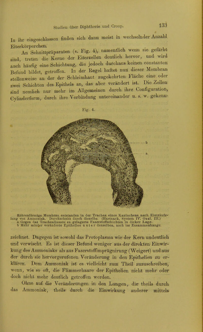 In ihr eingeschlossen finden sich dann meist in wechselnder Anzahl Eiterkörperchen. . An Schnittpräparaten (s. Fig. 4), namentlich wenn sie gefärbt sind treten die Kerne der Eiterzellen deutlich hervor, und wird auch häufig eine Schichtung, die jedoch durchaus keinen constanten Befund bildet, getroffen. In der Regel haftet nun dieser Membran steUenweise an der der Schleimhaut zugekehrten Fläche eme oder zwei Schichten des Epithels- an, das aber verändert ist. Die Zellen sind nemhch nur mehr im Allgemeinen durch ihre Configuration, Cylinderform, durch ihre Verbindung untereinander u. s. w. gekenn- Fig. 4. Röhrenförmige Membran, entstanden in der Trachea eines Kaninchens nach Einträufe- lung von Ammoniak. Durchschnitt durch dieselbe. (Hartnaclf, System IV. Oxal. III.) a Gegen das Tracheallumen zu gelagerte Faserstoffschichten in dicker Lage, b Mehr minder veränderte Epithelien unter denselben, noch im Zusammenhange. zeichnet. Dagegen ist sowohl das Protoplasma wie der Kern undeutlich und verwischt. Es ist dieser Befund weniger ans der direkten Einwir- kung des Ammoniaks als aus Faserstoffimprägnirung (Weigert) und aus dfer durch sie hervorgerufenen Veränderung in den Epithelien zu er- klären. Dem Ammoniak ist es vielleicht zum Theil zuzuschreiben, wenn, wie so oft, die Flimmerhaare der Epithelien nicht mehr oder doch nicht mehr deutlich getroffen werden. Ohne auf die Veränderungen in den Lungen, die theils durch das Ammoniak, theils durch die Einwirkung anderer mittels