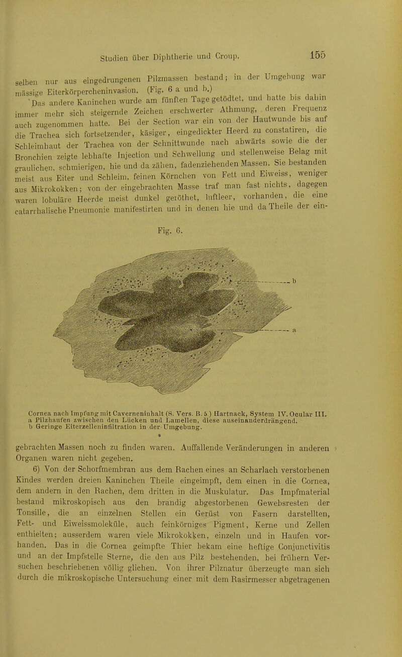 selben nur aus eingedrungenen Pikmassen bestand; in der Umgehung war inässige Eiterkörpercheninvasion. (Fig. 6 a und b.) , u • 'Das andere Kaninchen wurde am fünften Tage getödtet, und hatte bis dahin immer mehr sich steigernde Zeichen erschwerter Athmung deren Frequenz auch zugenommen hatte. Bei der Section war ein von der Hautwunde bis auf die Trachea sich fortsetzender, Icäsiger, eingediclcter Heerd zu constatiren, die Schleimhaut der Trachea von der Schnittwunde nach abwärts sowie die der Bronchien zeigte lebhafte Injection und Schwellung und stellenweise Belag mit graulichen, schmierigen, hie und da zähen, fadenziehenden Massen. Sie bestanden meist aus Eiter und Schleim, feinen Körnchen von Fett und Eiweiss, weniger au^ Mikrokokken; von der eingebrachten Masse traf man fast nichts, dagegen waren lobuläre Heerde meist dunkel geiöthet, luftleer, vorhanden, die eine catarrhalische Pneumonie manifestirlen und in denen hie und daTheile der ein- Fig. 6. Cornea nach Impfung mit Caverneninhalt (S. Vers. B. 5.) Hartnack, System IV. Ocular III. a Pilzhaufen zwischen den Lücken und Lamellen, diese auseinanderdrängend, b Geringe Eiterzelleninflltration in der Umgebung. gebrachten Massen noch zu finden waren. Auffallende Veränderungen in anderen Organen waren nicht gegeben. 6) Von der Schorfmerabran aus dem Rachen eines an Scharlach verstorbenen Kindes werden dreien Kaninchen Theile eingeimpft, dem einen in die Cornea, dem andern in den Rachen, dem dritten in die Muskulatur. Das Impfmaterial bestand mikroskopisch aus den brandig abgestorbenen Gewebsresten der Tonsille, die an einzelnen Stellen ein Gerüst von Fasern darstellten, Fett- und Eiweissmoleküle, auch feinkörniges Pigment, Kerne und Zellen enthielten; ausserdem waren viele Mikrokokken, einzeln und in Haufen vor- handen. Das in die Cornea geimpfte Thier bekam eine heftige Conjunctivitis und an der Impfstelle Sterne, die den aus Pilz bestehenden, bei frühern Ver- suchen beschriebenen völlig glichen. Von ihrer Pilznatur überzeugte man sich durch die mikroskopische Untersuchung einer mit dem Rasirmesser abgetragenen