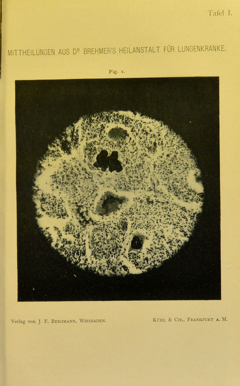 Tafel 1. MITTHEILUNGEN AUS DR BREHMER'S HEILANSTALT FÜR LUNGENKRANKE. Fig. i. Verlag von J. F. Bergmann, Wiesbaden.