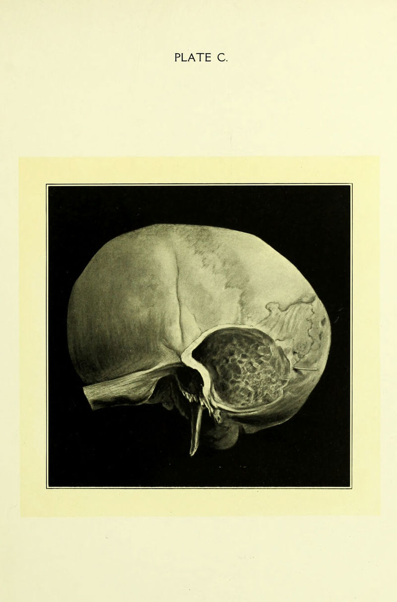 PLATE C.