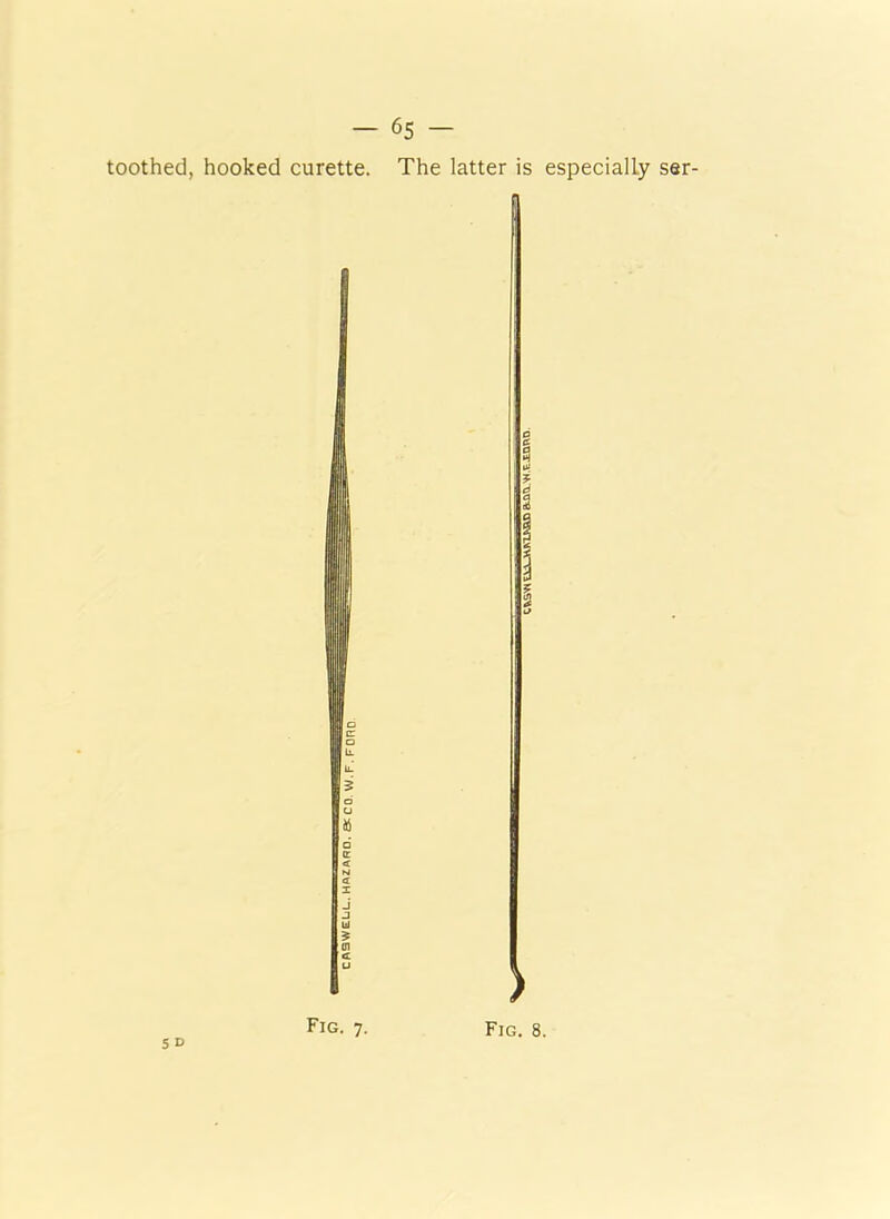 toothed, hooked curette. The latter is especially ser- 5 D b U □ c <r « X J J u £ m c u )