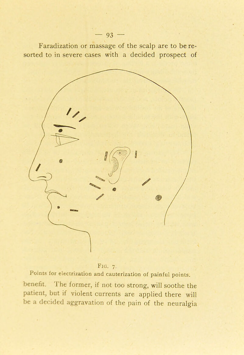 Faradization or massage of the scalp are to be re- sorted to in severe cases with a decided prospect of Fig. 7 Points for electrization and cauterization of painful points. benefit. The former, if not too strong, will soothe the patient, but if violent currents are applied there will be a decided aggravation of the pain of the neuralgia