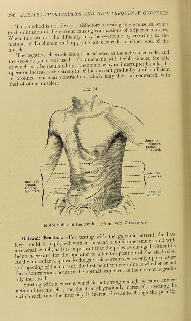 IIIGII-EEEQ UENCY CURRENTS This method is not always satisfactory in testing single muscles, owing to the diffusion of the current causing contractions of adjacent muscles. When this occurs, the difficulty may be overcome by resorting to the method of Duchenne, and applying an electrode to either end of the The neo-ative electrode should be selected as the active electrode, and the secondary current used. Commencing with feeble shocks, the rate of which may be regulated by a rheotome or by an interrupter handle, the operator increases the strength of the current gradually until sufficient to produee muscular contraction, which may then be compared with that of other muscles. TTin 74. Rectus'ab- dominis. Intercos- tal nerves. SerratuB magnuB. Laiissi- muB dorsi. Intercos- tal nerves. Trans, ab- dominis. Motor points of the trunk. (From von Ziemssen.) Galvanic Beaction.-For testing with the galvanic current, the bat- terv should be equipped with a rheostat, a milhamperemetCT, and witn a ILiTl switch,'aa‘ir is in,portant that the poles be changrf — ^ bpinn necessarv for the operator to alter the position of the electro ^ the muscular response to the galvanic current occurs “'X ^ ^ and opening of the current, the first point to determine is these Lntrfctions occur in the normal sequence, as the current „ '‘''^strrrwith a current which is not strong enough to cau^ action of tL muscles, and the strength gradually increased, res S sS each time the intensity is increased so as to change the polarity.