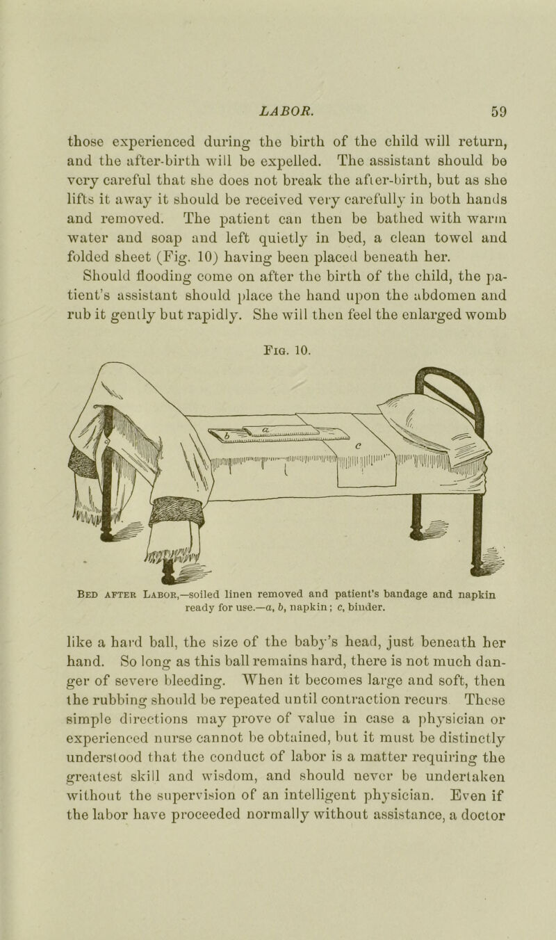those experienced during the birth of the child will return, and the after-birth will be expelled. The assistant should be vcry careful that she does not break the afier-birth, but as she lifts it away it should be received very carefully in both hands and removed. The patient can then be batlied with warm water and soap and left quietly in bed, a clean towel and folded sheet (Fig. 10) having been placed beneath her. Should floodiug corne on after the birth of the child, the pa- tient’s assistant should place the hand upon the abdomen and rub it gently but rapidly. She will then feel the enlarged wonib Fig. 10. Bed after Labor,— soiled linen removed and patient’s bandage and napkin ready for use.—a, b, napkin ; c, binder. like a hard bail, the size of the baby’s head, just beneath her hand. So long as this bail remains hard, there is not much dan- ger of severe bleeding. When it becomes large and soft, then the rubbing should be repeated until contraction recurs These simple directions may prove of value in case a physician or experienced nurse cannot be obtained, but it must be distinctly understood that the conduct of labor is a matter requiring the greatest ski 11 and wisdom, and should nevcr be undertaken without the supervision of an intelligent physician. Even if the labor bave proceeded normally without assistance, a doctor