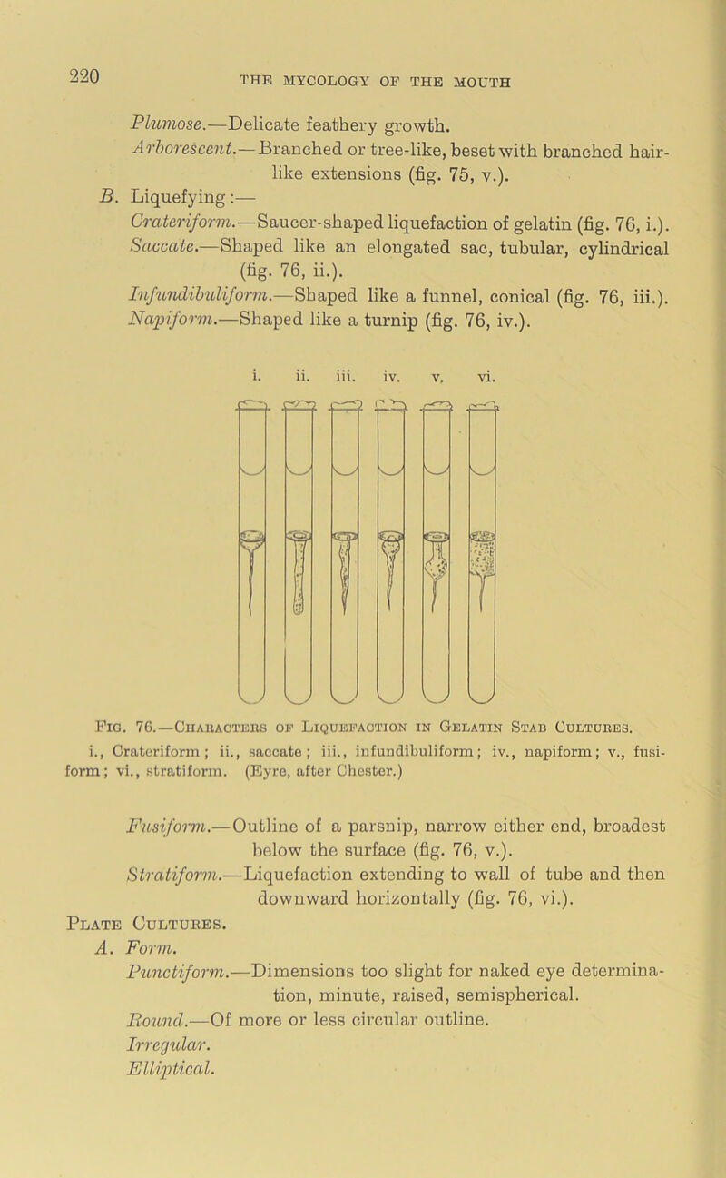 Plumose.—Delicate feathery growth. Arborescent.—Branched or tree-like, beset with branched hair- like extensions (fig. 75, v.). B. Liquefying:— Grateriform.—Saucer-shaped liquefaction of gelatin (fig. 76, i.). Saccate.—Shaped like an elongated sac, tubular, cylindrical (fig. 76, ii.). Infundibuliform.—Shaped like a funnel, conical (fig. 76, iii.). Napiform.—Shaped like a turnip (fig. 76, iv.). 1. 11. 111. IV. V. VI. — 2 Lx f—Y s ! ? W r ss 'id: T vJ W Pig. 7G.—Chakacters of Liquefaction in Gelatin Stab Cultures. i., Grateriform ; ii., saccate; iii., infundibuliform; iv., napiform; v., fusi- form; vi., stratiform. (Eyre, after Chester.) Fusiform.—Outline of a parsnip, narrow either end, broadest below the surface (fig. 76, v.). Stratiform.—Liquefaction extending to wall of tube and then downward horizontally (fig. 76, vi.). Plate Cultures. A. Form. Punctiform.—Dimensions too slight for naked eye determina- tion, minute, raised, semispherical. Bound.—Of more or less circular outline. Irregular. Elliptical.
