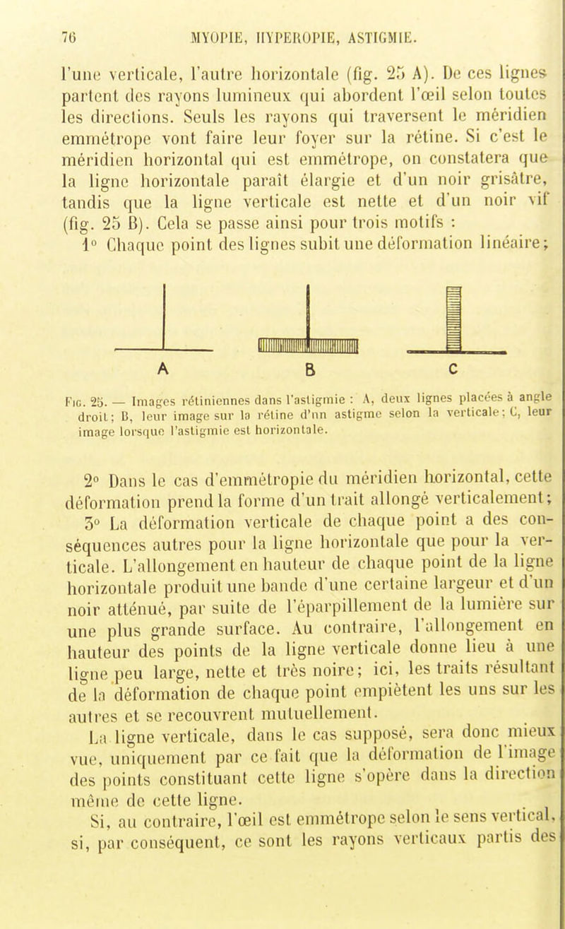 l'une verticale, l'autre horizontale (fig. 25 A). De ces lignes partent des rayons lumineux qui abordent l'œil selon toutes les directions. Seuls les rayons qui traversent le méridien emmétrope vont faire leur foyer sur la rétine. Si c'est le méridien horizontal qui est emmétrope, on constatera que la ligne horizontale paraît élargie et d'un noir grisâtre, tandis que la ligne verticale est nette et d'un noir vif (fig. 25 B). Cela se passe ainsi pour trois motifs : 1° Chaque point des lignes subit une déformation linéaire; ABC Fig. 2b. — Images rétiniennes dans l'asligmie : A, deux lignes placées à angle droil; B, leur image sur la réline d'nn astigme selon la verticale ;C, leur image lorsque l'asligmie esl horizontale. 2° Dans le cas d'emmétropic du méridien horizontal, cette déformation prend la forme d'un Irait allongé verticalement; 3 La déformation verticale de chaque point a des con- séquences autres pour la ligne horizontale que pour la ver- ticale. L'allongement en hauteur de chaque point de la ligne horizontale produit une bande d'une certaine largeur et d'un noir atténué, par suite de l'éparpillement de la lumière sur une plus grande surface. Au contraire, l'allongement en hauteur des points de la ligne verticale donne lieu à une ligne peu large, nette et très noire; ici, les traits résultant de la déformation de chaque point empiètent les uns sur les autres et se recouvrent mutuellement. La ligne verticale, dans le cas supposé, sera donc mieux vue, uniquement par ce fait que la déformation de l'image des points constituant cette ligne s'opère dans la direction même de cette ligne. Si, au contraire, l'œil esl emmétrope selon le sens vertical, si, par conséquent, ce sont les rayons verticaux partis des