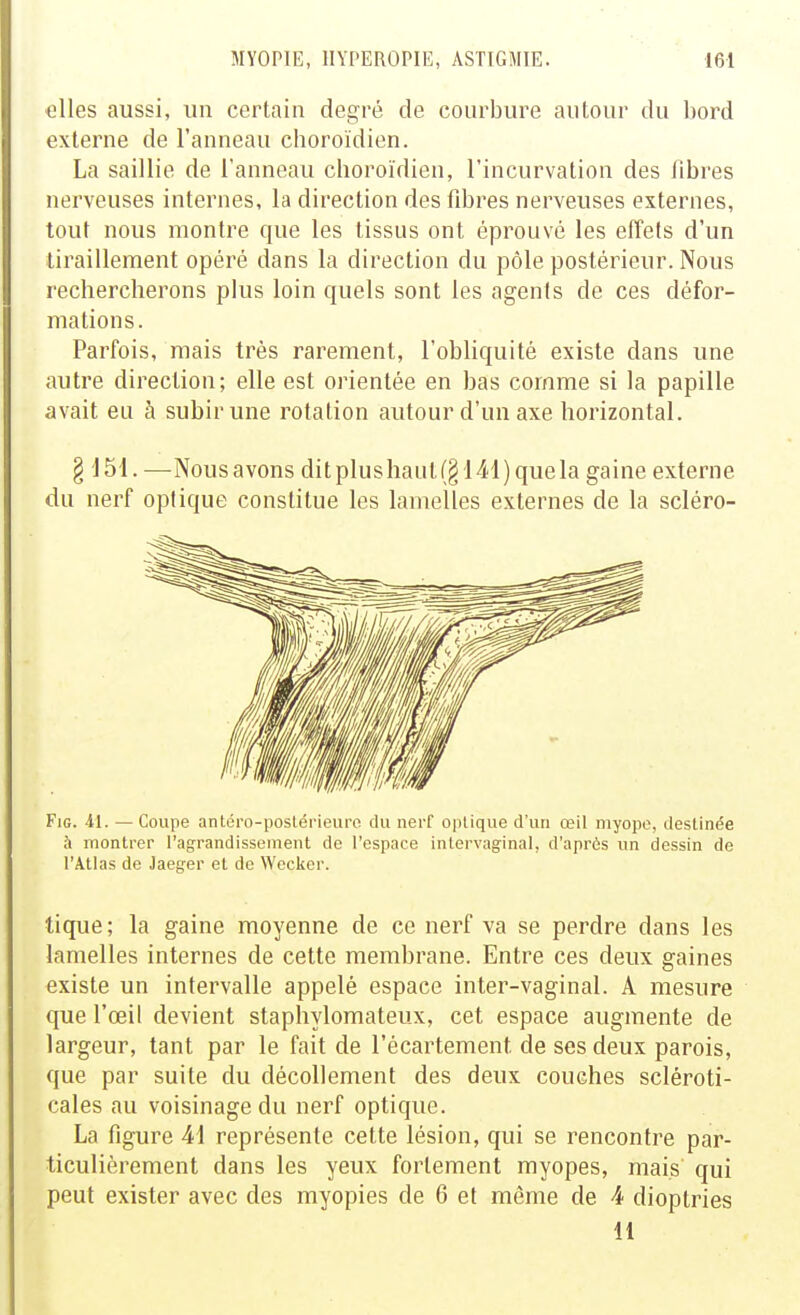 elles aussi, un certain degré de courbure autour du bord externe de l'anneau choroïdien. La saillie de l'anneau choroïdien, l'incurvation des fibres nerveuses internes, la direction des fibres nerveuses externes, tout nous montre que les tissus ont éprouvé les effets d'un tiraillement opéré dans la direction du pôle postérieur. Nous rechercherons plus loin quels sont les agents de ces défor- mations. Parfois, mais très rarement, l'obliquité existe dans une autre direction; elle est orientée en bas comme si la papille avait eu à subir une rotation autour d'un axe horizontal. § 151. —Nousavons ditplushaut(§141)quela gaine externe du nerf optique constitue les lamelles externes de la scléro- FiG. -11. — Coupe antiii'o-postérieuro du nerf optique d'un œil myope, destinée à montrer l'agrandissement de l'espace inlorvaginal, d'après un dessin de l'Atlas de Jaeg-er et de Wecker. tique; la gaine moyenne de ce nerf va se perdre dans les lamelles internes de cette membrane. Entre ces deux gaines existe un intervalle appelé espace inter-vaginal. A mesure que l'œil devient staphylomateux, cet espace augmente de largeur, tant par le fait de l'écartement de ses deux parois, que par suite du décollement des deux couches scléroti- cales au voisinage du nerf optique. La figure Ai représente cette lésion, qui se rencontre par- ticulièrement dans les yeux fortement myopes, mais qui peut exister avec des myopies de 6 et même de 4 dioptries 11