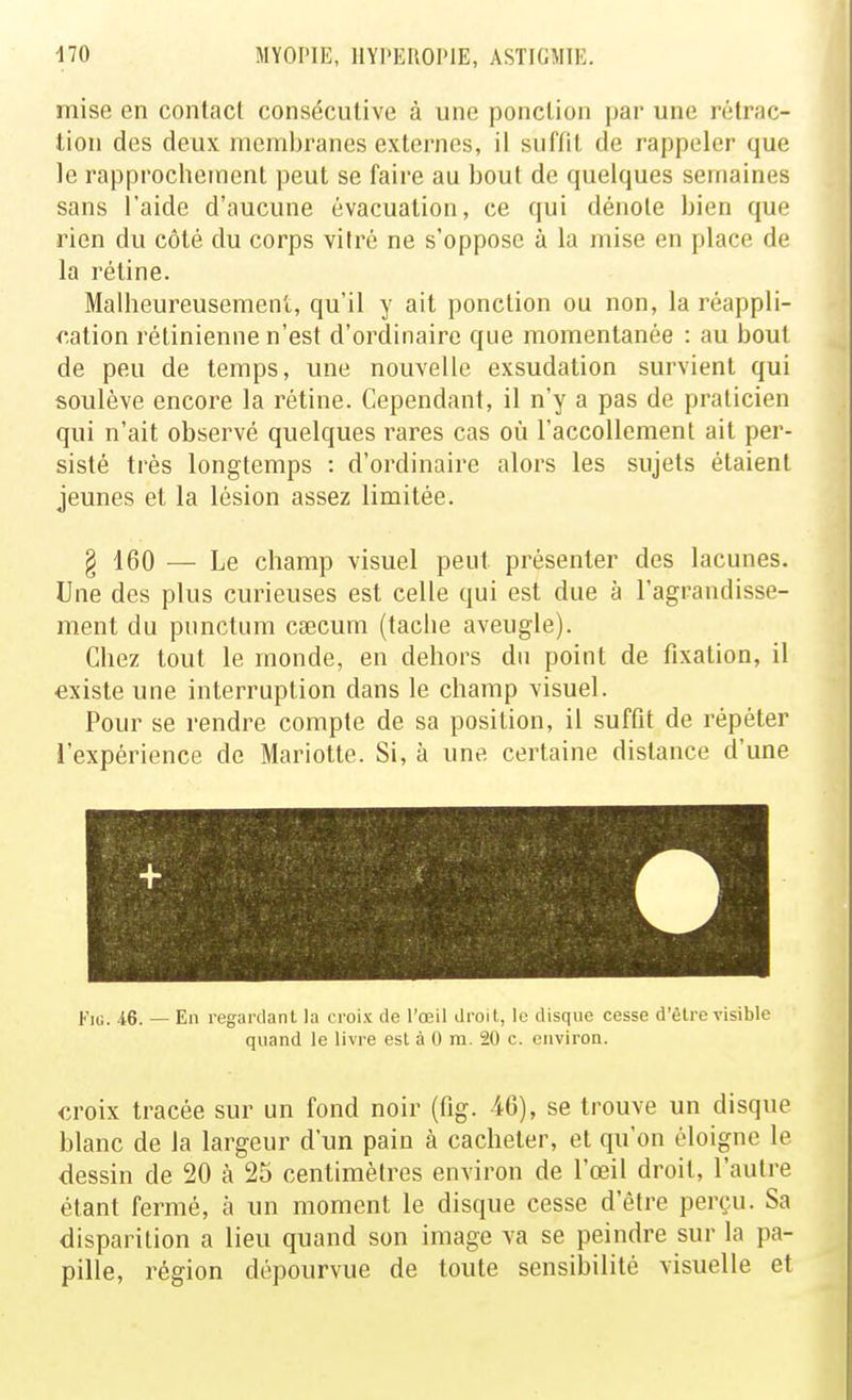 mise en contact consécutive à une ponction par une rétrac- tion des deux membranes externes, il suffit de rappeler que le rapprochement peut se faire au bout de quelques semaines sans l'aide d'aucune évacuation, ce qui dénote bien que rien du côté du corps vitré ne s'oppose à la mise en place de la rétine. Malheureusement, qu'il y ait ponction ou non, la réappli- r.ation rétinienne n'est d'ordinaire que momentanée : au bout de peu de temps, une nouvelle exsudation survient qui soulève encore la rétine. Cependant, il n'y a pas de praticien qui n'ait observé quelques rares cas où l'accoUement ait per- sisté très longtemps : d'ordinaire alors les sujets étaient jeunes et la lésion assez limitée. § 160 — Le champ visuel peut présenter des lacunes. Une des plus curieuses est celle qui est due à l'agrandisse- ment du punctum caecum (tache aveugle). Chez tout le monde, en dehors du point de fixation, il existe une interruption dans le champ visuel. Pour se rendre compte de sa position, il suffit de répéter l'expérience de Mariette. Si, à une certaine distance d'une FiG. 46. — En regarclanl la croix de l'œil droil, le disque cesse d'être visible quand le livre esL à 0 m. 20 c. environ. croix tracée sur un fond noir (fig. 46), se trouve un disque blanc de la largeur d'un pain à cacheter, et qu'on éloigne le dessin de 20 à 25 centimètres environ de l'œil droit, l'autre étant fermé, à un moment le disque cesse d'éti'e perçu. Sa disparition a lieu quand son image va se peindre sur la pa- pille, région dépourvue de toute sensibilité visuelle et