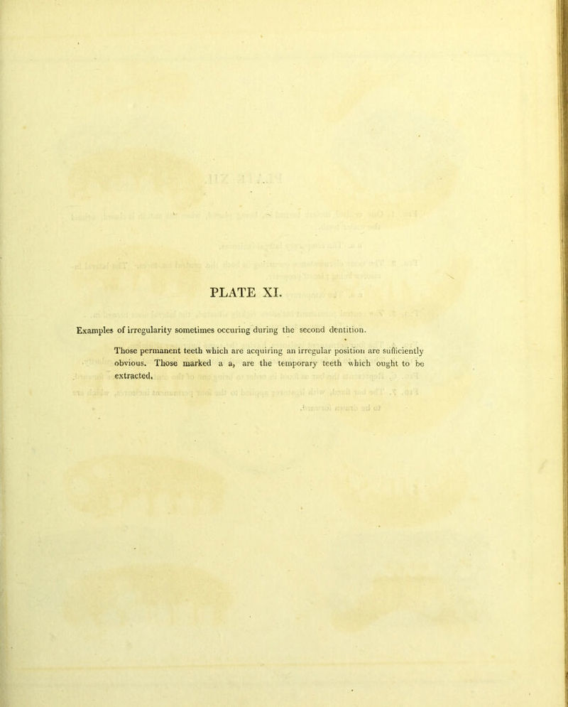 Examples of irregularity sometimes occuring during the second dentition. Those permanent teeth which are acquiring an irregular position are sufficiently obvious. Those marked a a, are the temporary teeth which ought to be extracted.
