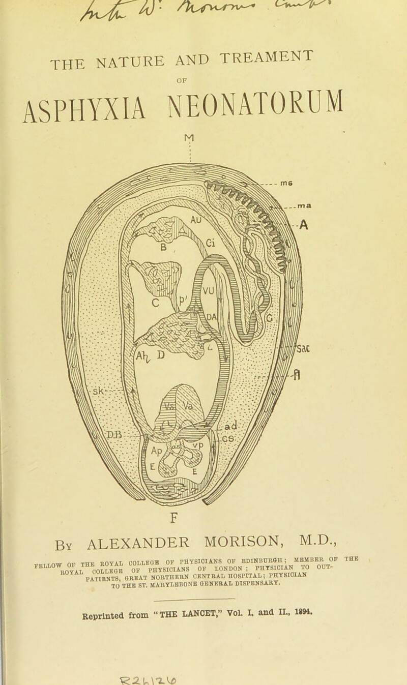 THE NATURE AND TREAMENT OF ASPHYXIA NEONATORUM M F By ALEXANDER MORISON, M.D., n» THK ROYAL COLLEGE OP PHYSICIANS OF BDlNIinilGH ; MEMBER OF THE FELLOW OF THE ROYAL COLL . pH^siCIAN TO OUT- IlOYA NORTUERN CENTRAL HOSPITAL; PHYSICIAN TO THE ST. MARTLBBONB GENERAL DISPENSARY. Reprinted from THE LANCET, VoL L and II.. 1894.