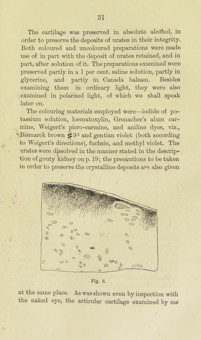 The cartilage was preserved in absolute alcdhol, in order to preserve the deposits of urates in their integrity. Both coloured and uncoloured preparations were made use of in part with the deposit of urates retained, and in part, after solution of it. The preparations examined were preserved partly in a 1 per cent, saline solution, partly in glycerine, and partly in Canada balsam. Besides examining them in ordinary light, they were also .examined in polarised light, of which we shall speak later on. The colouring materials employed were—iodide of po- tassium solution, haematoxylin, Grenadier’s alum car- mine, Weigert’s picro-carmine, and aniline dyes, viz., ' Bismarck brown 95 and gentian violet (both according to Weigert’s directions), fuchsin, and methyl violet. The urates were dissolved in the manner stated in the descrip- tion of gouty kidney on p. 19; the precautions to be taken in order to preserve the crystalline deposits are also given rig. 6. at tlie same place. As was shown even by inspection with the naked eye, the articular cartilage examined by me