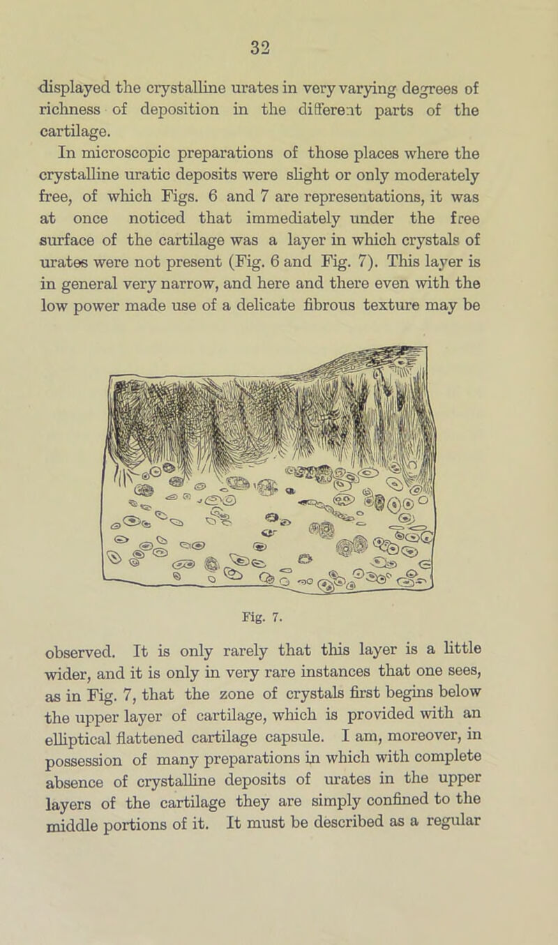 displayed the crystalline urates in very varying degrees of richness of deposition in the different parts of the cartilage. In microscopic preparations of those places where the crystalline uratic deposits were slight or only moderately free, of which Figs. 6 and 7 are representations, it was at once noticed that immediately under the free surface of the cartilage was a layer in which crystals of urates were not present (Fig. 6 and Fig. 7). This layer is in general very narrow, and here and there even with the low power made use of a delicate fibrous texture may be Fig. 7. observed. It is only rarely that this layer is a little wider, and it is only in very rare instances that one sees, as in Fig. 7, that the zone of crystals first begins below the upper layer of cartilage, which is provided with an elliptical flattened cartilage capsule. I am, moreover, in possession of many preparations in which with complete absence of crystalline deposits of urates in the upper layers of the cartilage they are simply confined to the middle portions of it. It must be described as a regular