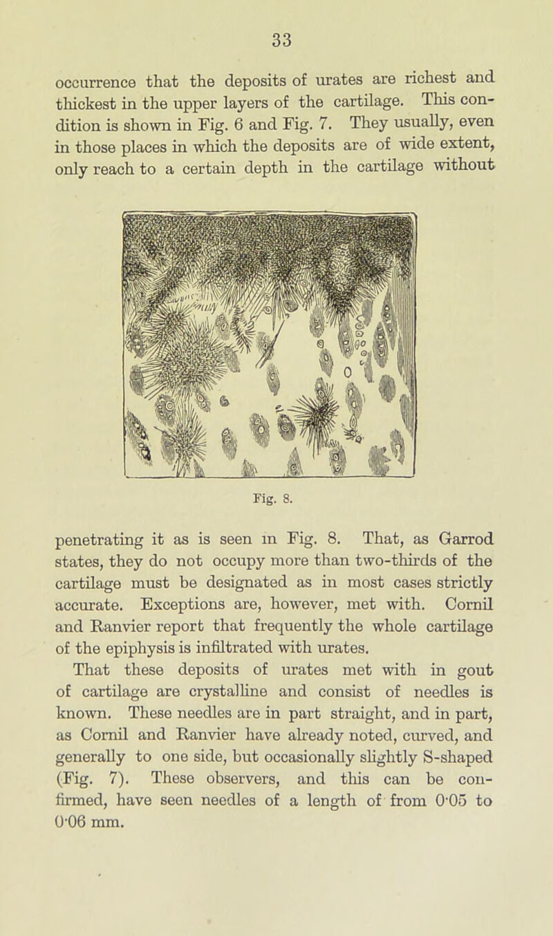 occurrence that the deposits of urates are richest and thickest in the upper layers of the cartilage. This con- dition is shown in Fig. 6 and Fig. 7. They usually, even in those places in which the deposits are of wide extent, only reach to a certain depth in the cartilage without Fig. 8. penetrating it as is seen in Fig. 8. That, as Garrod states, they do not occupy more than two-thirds of the cartilage must be designated as in most cases strictly accurate. Exceptions are, however, met with. Comil and Ranvier report that frequently the whole cartilage of the epiphysis is infiltrated with urates. That these deposits of urates met with in gout of cartilage are crystalline and consist of needles is known. These needles are in part straight, and in part, as Comil and Ranvier have already noted, curved, and generally to one side, but occasionally slightly S-shaped (Fig. 7). These observers, and this can be con- firmed, have seen needles of a length of from 0'05 to 0-06 mm.