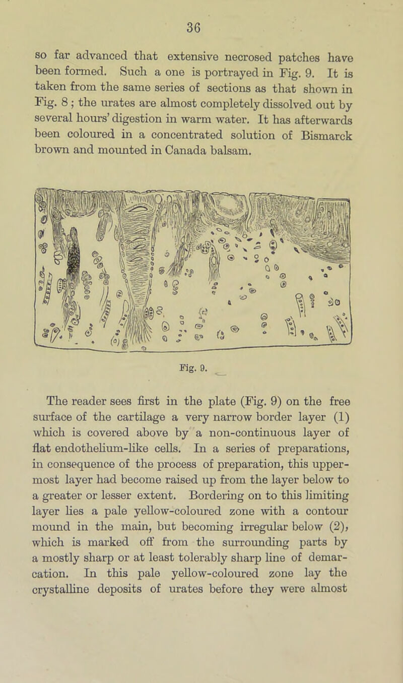 so far advanced that extensive necrosed patches have been formed. Such a one is portrayed in Fig. 9. It is taken from the same series of sections as that shown in Fig. 8 ; the urates are almost completely dissolved out by several hours’ digestion in warm water. It has afterwards been coloured in a concentrated solution of Bismarck brown and mounted in Canada balsam. Fig. 9. The reader sees first in the plate (Fig. 9) on the free surface of the cartilage a very narrow border layer (1) which is covered above by a non-continuous layer of flat endothelium-like cells. In a series of preparations, in consequence of the process of preparation, this upper- most layer had become raised up from the layer below to a greater or lesser extent. Bordering on to this limiting layer lies a pale yellow-coloured zone with a contour mound in the main, but becoming irregular below (2), which is marked off from the surrounding parts by a mostly sharp or at least tolerably sharp line of demar- cation. In this pale yellow-coloured zone lay the crystalline deposits of urates before they were almost