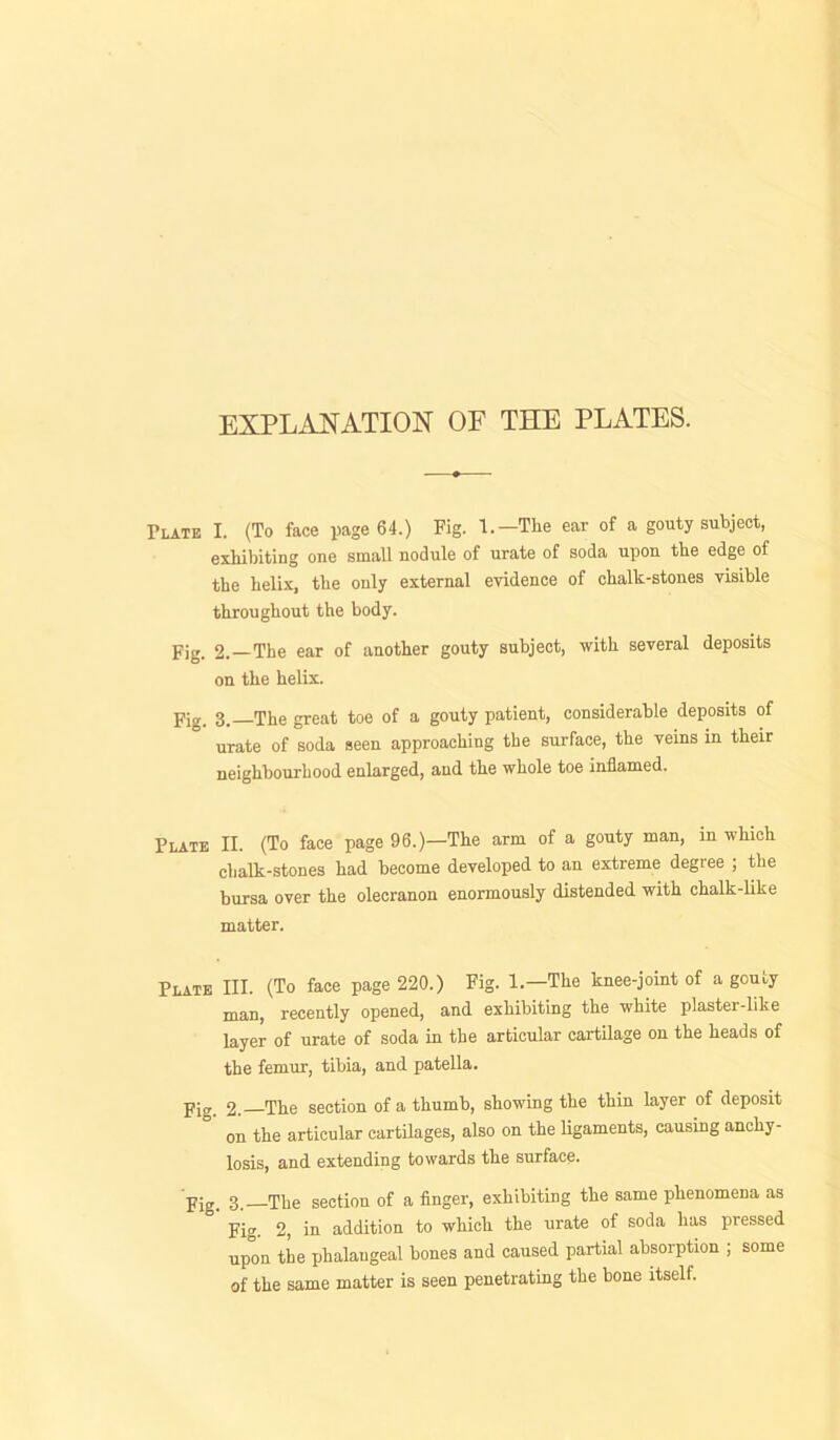 EXPLANATION OF THE PLATES. Plate I. (To face page 64.) Fig. 1.—The ear of a gouty subject, exhibiting one small nodule of urate of soda upon the edge of the helix, the only external evidence of chalk-stones visible throughout the body. Fig. 2.—The ear of another gouty subject, with several deposits on the helix. Fig. 3.—The great toe of a gouty patient, considerable deposits of urate of soda seen approaching the surface, the veins in their neighbourhood enlarged, and the whole toe inflamed. Plate II. (To face page 96.)—The arm of a gouty man, in which chalk-stones had become developed to an extreme degree ; the bursa over the olecranon enormously distended with chalk-like matter. Plate III. (To face page 220.) Fig. 1.—The knee-joint of a gouty man, recently opened, and exhibiting the white plaster-like layer of urate of soda in the articular cartilage on the heads of the femur, tibia, and patella. Fig. 2. The section of a thumb, showing the thin layer of deposit on the articular cartilages, also on the ligaments, causing anchy- losis, and extending towards the surface. Fig. 3. The section of a finger, exhibiting the same phenomena as Fig. 2, in addition to which the urate of soda has pressed upon the phalangeal bones and caused partial absorption ; some of the same matter is seen penetrating the bone itself.