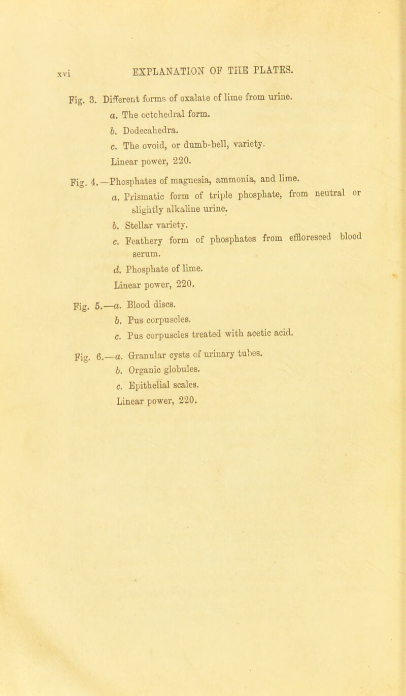 Fig. 3. Different forms of oxalate of lime from urine, o. The octoheJral form. 6. Dodecahedra. c. The ovoid, or dumh-hell, variety. Linear power, 220. Fig, 4.—Phosphates of magnesia, ammonia, and lime. а. Prismatic form of triple phosphate, from neutral or slightly alkaline urine. б. Stellar variety. c. Feathery form of phosphates from effloresced blood serum. d. Phosphate of lime. Linear power, 220. Fig. 5.—a. Blood discs. 6. Pus corpuscles. c. Pus corpuscles treated with acetic acid. Fig. 6.—a. Granular cysts of urinai-y tubes. 6. Organic globules, c. Epithelial scales. Linear power, 220.