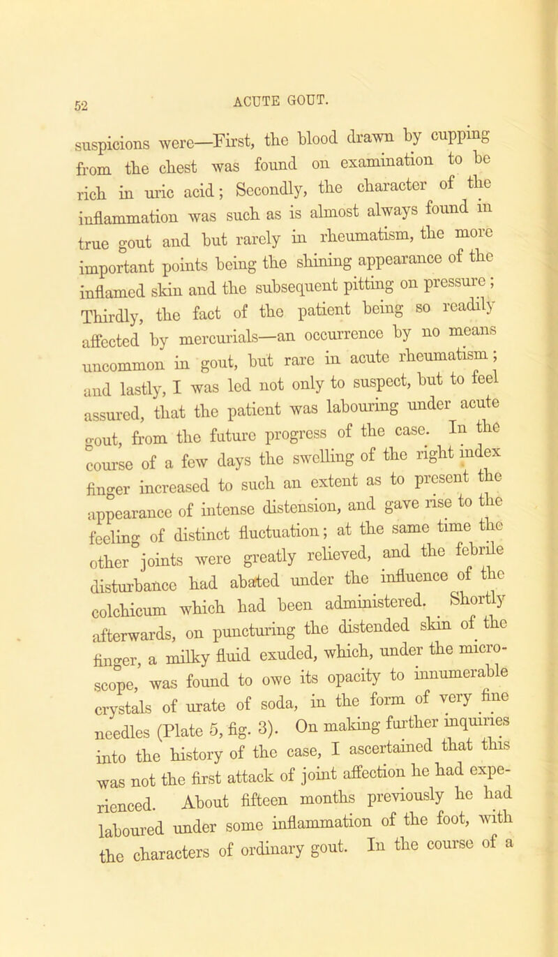 suspicions were—First, tFe blood drawn by cupping from tbe cbest was found on examination to be rich in uidc acid; Secondly, tbe character of the inflammation was such as is almost always found in true gout and but rarely in rheumatism, the more important pomts being the shining appearance of the inflamed skin and the subsequent pitting on pressure; Thirdly, the fact of the patient being so readily aff'ected by mercurials—an occurrence by no means uncommon in gout, but rare in acute rheumatism; and lastly, I was led not only to suspect, but to teel assured, that the patient was labouring under acute o-out, from the future progress of the case. In the course of a few days the swelling of the right mdex finger increased to such an extent as to present the appearance of intense distension, and gave nse to the feeling of distinct fluctuation; at the same time the other joints were greatly reheved, and the febrile distm-bance had abated under the influence of the colchicum which had been administered. ^ Shortly afterwards, on puncturing the distended skin of t o linger, a milky fluid exuded, which, under the micro- scope,’ was found to owe its opacity to innumerable crystals of urate of soda, in the form of very fine needles (Plate 5, fig. 3). On making further into the history of the case, I ascertamed that this was not the first attack of joint affection he had expe- rienced. About fifteen months previously he had laboured under some inflammation of the foot, with the characters of ordinary gout. In the course of a