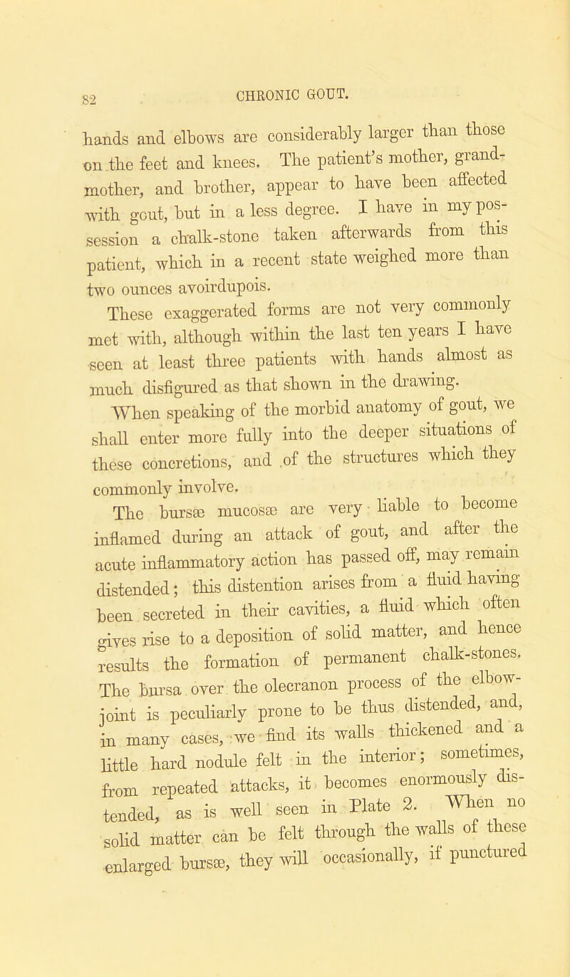 8-2 hands and elbows are considerably larger than those on the feet and knees. The patient’s mother, grand- mother, and brother, appear to have been affected with gout, hut in a less degree. I have in my pos- session a chalk-stone taken afterwards from this patient, which in a recent state weighed more than two ounces avoirdupois. These exaggerated forms are not very commonly met with, although within the last ten years I have seen at least three patients with hands almost as much disfigured as that shown in the drawing. When speaking of the morbid anatomy of gout, we shall enter more fully into the deeper situations of these concretions, and .of the structures which they commonly involve. The bursal mucosee are very Hahle to become inflamed during an attack of gout, and after the acute inflammatory action has passed off, may remain distended; this distention arises from a fluid having been secreted in their cavities, a flmd which often oiyes rise to a deposition of soUd matter, and hence results the formation of permanent chalk-stones. The bui’sa over the olecranon process of the elbow- ioint is peculiarly prone to be thus distended, and, in many cases, we find its waUs thickened and a little hard nodule felt in the interior; sometimes, from repeated attacks, it. becomes enormously dis- tended, as is well seen in Hate 2. When no solid matter can be felt through the walls of these enlarged bursai, they mU occasionally, if punctured