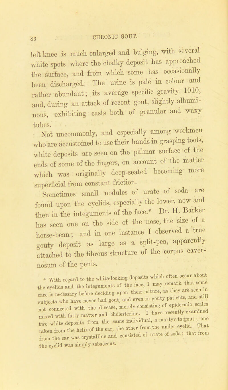 left knee is muck enlarged and bulging, 'vvitk several white spots where the chalky deposit has approached the surface, and from which some has occasionally been discharged. The urine is pale in colour and rather abundant; its average specific gravity 1010, and, during an attack of recent gout, slightly albumi- nous, exhibiting casts both of granular and waxy tubes. Not uncommonly, and especially among workmen who are accustomed to use their hands in grasping tools, white deposits are seen on the palmar surface of the ends of some of the fingers, on account of the matter which Avas originally deep-seated becoming more superficial from constant friction. Sometimes small nodules of urate of soda are found upon the eyelids, especially the lower, now and then in the integuments of the face.* Dr. H.^ Barker has seen one on the side of the nose, the size of a horse-bean; and in one instance I observed a true gouty deposit as large as a split-pea, apparently attached to the fibrous structure of the corpus caver- nosum of the penis. * With regard to the ^vhite-looHng deposits rvhich often occur about the eyelids and the integuments of the face, I may remark that some care is necessary before deciding upon their nature, as they are seen subjects who have never had gout, and even in gouty pa len s, a not connected with the disease, merely consisting of epidpic scales Ld with fatty matter and cholesterine. I have recen ly exammed two white deposits from the same individual, a martyr to^out . one taken from the helix of the ear, the other from the under eyelid. That from the ear was crystalline and consisted of urate of soda; that from the eyelid was simply sebaceous.