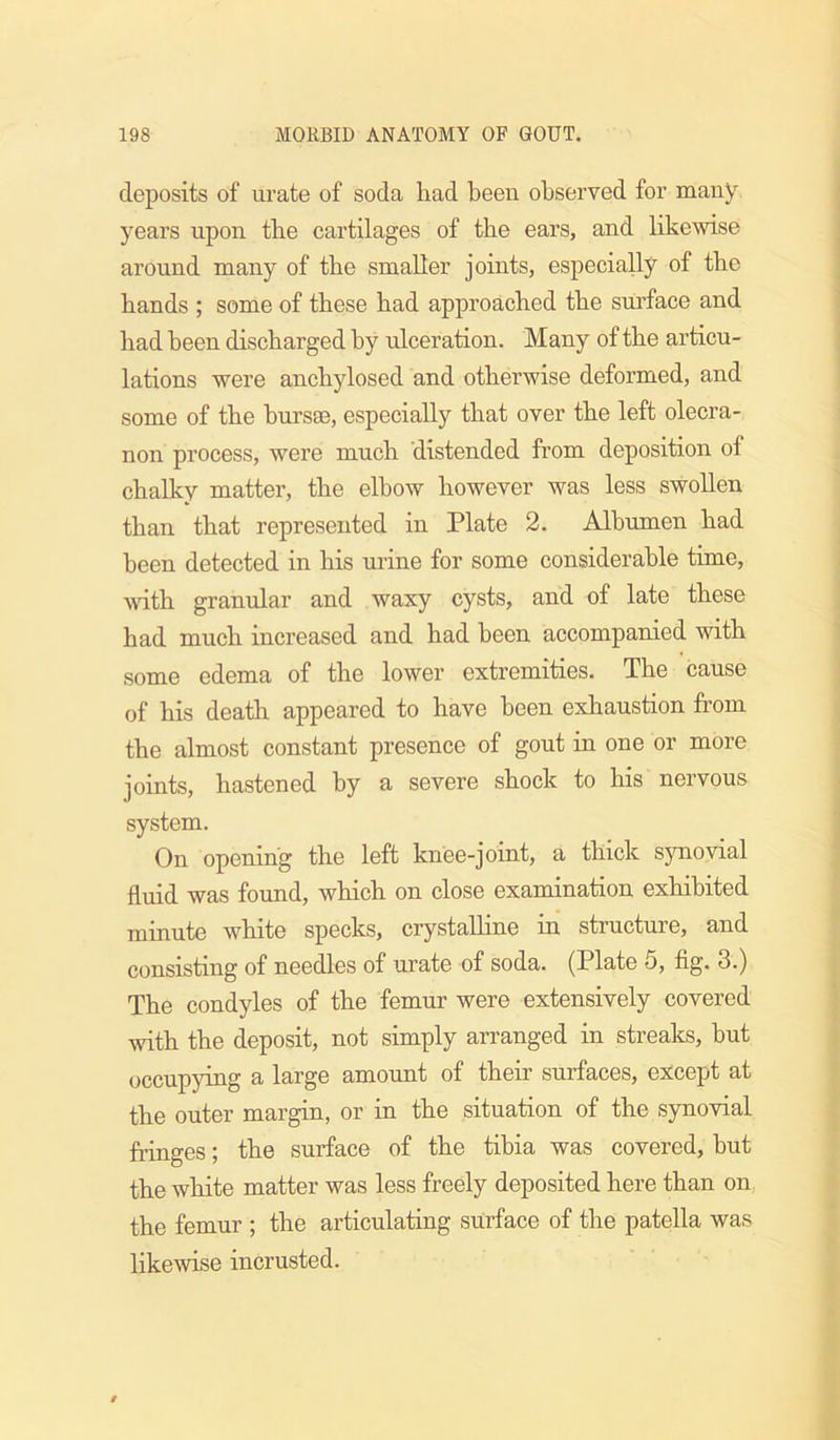 deposits of urate of soda had been observed for many years upon the cartilages of the ears, and likewise around many of the smaller joints, especiaUy of the bands ; some of these bad approached the surface and bad been discharged by ulceration. Many of the articu- lations were ancbylosed and otherwise deformed, and some of the bursae, especially that over the left olecra- non process, were much distended from deposition of chalky matter, the elbow however was less swollen than that represented in Plate 2. Albumen bad been detected in bis urine for some considerable time, ^vith granular and waxy cysts, and of late these bad much increased and had been accompanied with some edema of the lower extremities. The cause of bis death appeared to have been exhaustion from the almost constant presence of gout in one or more joints, hastened by a severe shock to bis nervous system. On opening the left knee-joint, a thick synovial fluid was found, which on close examination exhibited minute white specks, crystaUine in structure, and consisting of needles of urate of soda. (Plate 5, fig. 3.) The condyles of the femur were extensively covered with the deposit, not simply arranged in streaks, but occupying a large amount of their surfaces, except at the outer margin, or in the situation of the synovial fringes; the surface of the tibia was covered, but the white matter was less freely deposited here than on the femur ; the articulating surface of the patella was likewise incrusted.