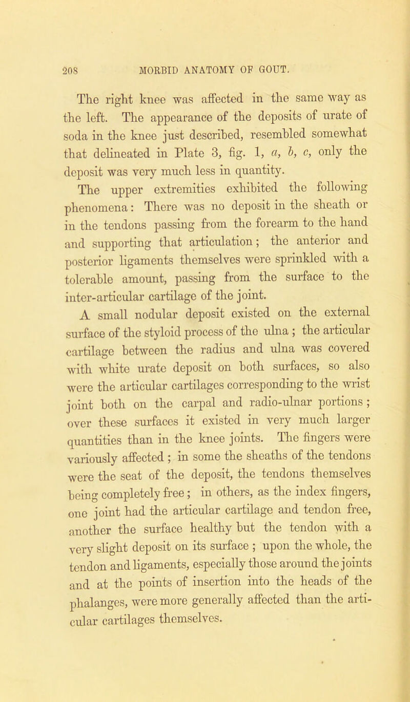 The right knee was affected in the same way as the left. The appearance of the deposits of nrate of soda in the knee just described, resembled somewhat that delineated in Plate 3, fig. 1, a, b, c, only the deposit was very much less in quantity. The upper extremities exhibited the following phenomena: There was no deposit in the sheath or in the tendons passing from the forearm to the hand and snpporting that articulation; the anterior and posterior ligaments themselves were sprinkled with a tolerable amount, passing from the snrface to the inter-articular cartilage of the joint. A small nodular deposit existed on the external surface of the styloid process of the ulna ; the articular cartilage between the radius and ulna was covered with white urate deposit on both surfaces, so also were the articular cartilages corresponding to the widst joint both on the carpal and radio-nlnar portions ; over these surfaces it existed in very much larger quantities than in the knee joints. The fingers were variously affected ; in some the sheaths of the tendons were the seat of the deposit, the tendons themselves being completely free; in others, as the index fingers, one joint had the articular cartilage and tendon free, another the surface healthy but the tendon with a very slight deposit on its surface ; upon the whole, the tendon and ligaments, especially those aronnd the joints and at the points of insertion into the heads of the phalanges, were more generally affected than the arti- cular cartilages themselves.