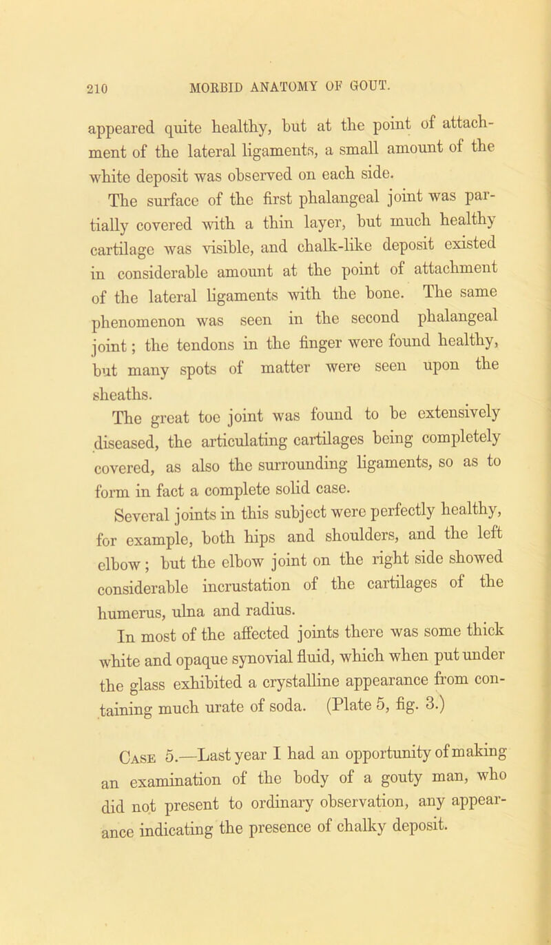 appeared quite healthy, but at the point of attach- ment of the lateral ligaments, a small amount of the white deposit was observed on each side. The surface of the first phalangeal joint was par- tially covered with a thin layer, hut much healthy cartilage was visible, and challc-like deposit existed in considerable amount at the point of attachment of the lateral Hgaments with the hone. The same phenomenon was seen in the second phalangeal joint; the tendons in the finger were found healthy, but many spots of matter were seen upon the sheaths. The great toe joint was found to be extensively diseased, the articulating cartilages being completely covered, as also the surrounding ligaments, so as to form in fact a complete soHd case. Several joints in this subject were perfectly healthy, for example, both hips and shoulders, and the left elbow; hut the elbow joint on the right side showed considerable incrustation of the cartilages of the humerus, ulna and radius. In most of the affected joints there was some thick white and opaque synovial fluid, which when put under the glass exhibited a crystalHne appearance from con- taining much urate of soda. (Plate 5, fig. 3.) Case 5.—Last year I had an opportunity of making an examination of the body of a gouty man, who did not present to ordinary observation, any appear- ance indicating the presence of chalky deposit.