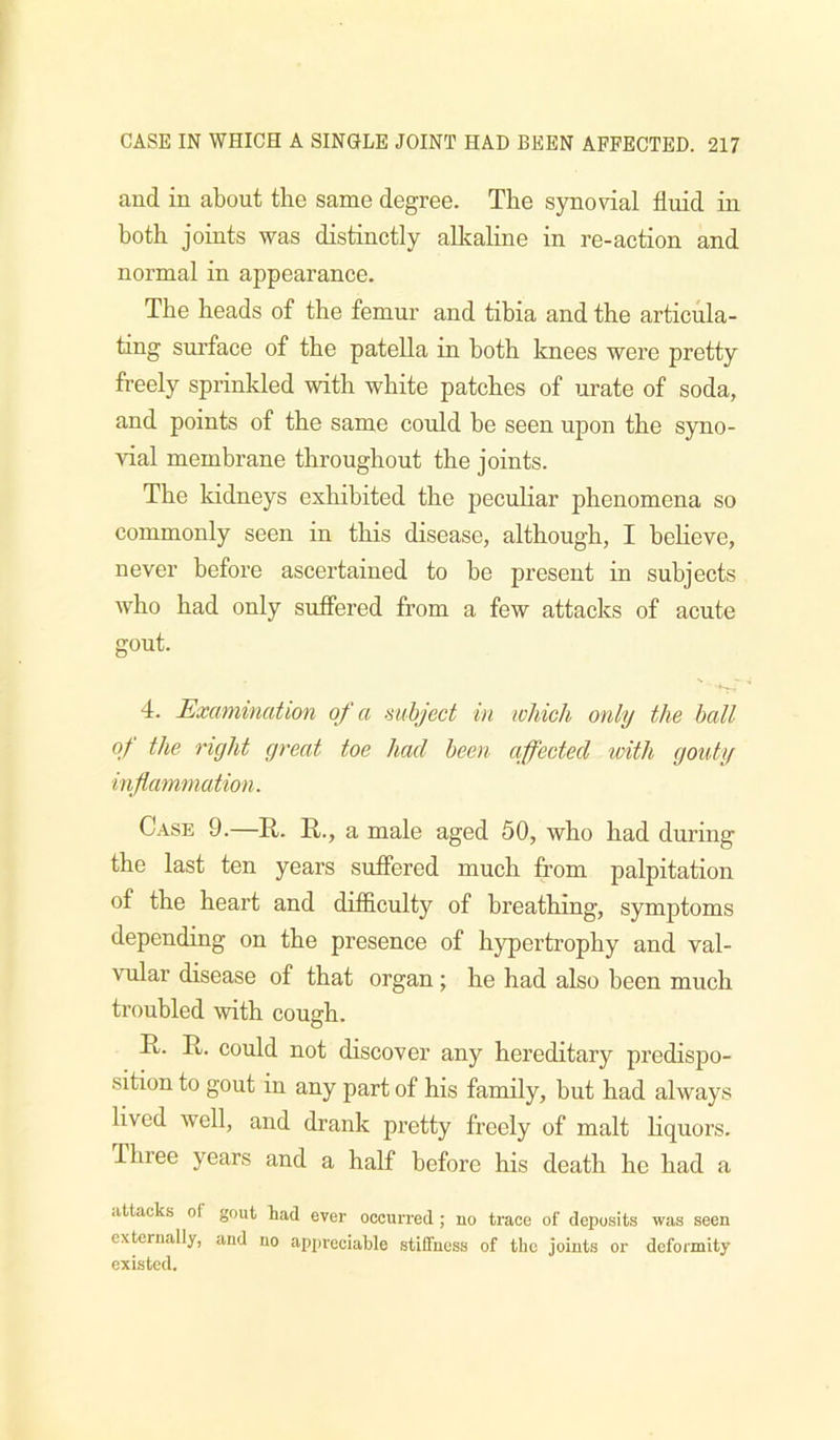 and in about the same degree. The synovial fluid in both joints was distinctly allcaline in re-action and normal in appearance. The heads of the femur and tibia and the articula- ting surface of the patella in both knees were pretty freely sprinkled with white patches of mate of soda, and points of the same could be seen upon the syno- vial membrane throughout the joints. The kidneys exhibited the peculiar phenomena so commonly seen in this disease, although, I beheve, never before ascertained to be present in subjects who had only suffered from a few attacks of acute gout. 4. Examination of a subject in loliicli only the hall qt the right great toe had been affected with gouty inflammation. Case 9.—R. R., a male aged 50, who had during the last ten years suffered much from palpitation of the heart and difficulty of breathing, symptoms depending on the presence of hypertrophy and val- vular disease of that organ; he had also been much troubled with cough. R. R. could not discover any hereditary predispo- sition to gout in any part of his family, but had always lived well, and drank pretty freely of malt liquors. Three years and a half before his death he had a attacks of gout tad ever occurred; no trace of deposits was seen externally, and no ap2)reciable stiffness of the joints or deformity existed.