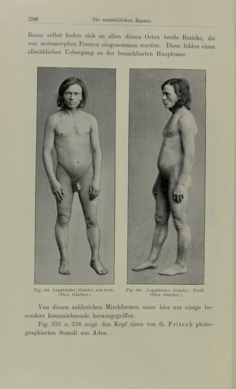 liasse selbst linden sicli an alien diesen Orten breite Bezirke, die \on metamorpben Formen eingenommen werden. Diese bilden einen allnniblichen Uebergang zu der benachbarten Hauptrasse Fig. 335. Lapplander, blonder, von vorn. Fig. 336. Lapplttnder, blonder. Profll. (Phot. Giinther.) (Phot. Gilnther.) Von diesen zahlreicken Mischformen seien bier nur einige be- sonders kennzeichnende herausgegriffen. Fig. 333 u. 334 zeigt den Kopf eines von G. Frit.sell plioto- grapbierten Somali aus Aden.