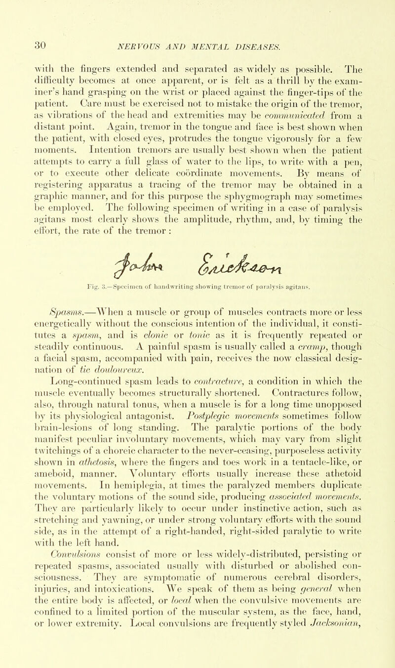 with the fingers extended and separated as widely as possible. The difficulty becomes at once apparent, or is felt as a thrill by the exam- iner's hand grasping on the wrist or placed against the finger-tips of the patient. Care must be exercised not to mistake the origin of the tremor, as vibrations of the head and extremities may be communicated from a distant point. Again, tremor in the tongue and face is best shown when the patient, with closed eyes, protrudes the tongue vigorously for a few moments. Intention tremors are usually best shown when the patient attempts to carry a full glass of water to the lips, to write with a pen, or to execute other delicate coordinate movements. By means of registering apparatus a tracing of the tremor may be obtained in a graphic manner, and for this purpose the sphygmograph may sometimes be employed. The following specimen of writing in a case of paralysis agitans most clearly shows the amplitude, rhythm, and, by timing the ell'ort, the rate of the tremor: Fig. 3.—Specimen of handwriting showing tremor of paralysis agitans. Spasms.—When a muscle or group of muscles contracts more or less energetically without the conscious intention of the individual, it consti- tutes a spasm, and is clonic or tonic as it is frequently repeated or steadily continuous. A painful spasm is usually called a cramp, though a facial spasm, accompanied with pain, receives the now classical desig- nation of tic douloureux. Long-continued spasm leads to contracture, a condition in which the muscle eventually becomes structurally shortened. Contractures follow, also, through natural tonus, when a muscle is for a long time unopposed by its physiological antagonist. Postplegic movements sometimes follow 1)rain-lesions of long standing. The paralytic portions of the body manifest peculiar involuntary movements, which may vary from slight twitchings of a choreic character to the never-ceasing, purposeless activity shown in athetosis, where the fingers and toes work in a tentacle-like, or ameboid, manner. Voluntary efforts usually increase these athetoid movements. In hemiplegia, at times the paralyzed members duplicate the voluntary motions of the sound side, producing associated movements. They are particularly likely to occur under instinctive action, such as stretching and yawning, or under strong voluntary efforts with the sound side, as in the attempt of a right-handed, right-sided paralytic to write with the left hand. Convulsions consist of more or less widely-distributed, persisting or repeated spasms, associated usually with disturbed or abolished con- sciousness. They are symptomatic of numerous cerebral disorders, injuries, and intoxications. We speak of them as being general when the entire body is affected, or local when the convulsive movements are confined to a limited portion of the muscular system, as the face, hand, or lower extremity. Local convulsions are frequently styled Jachsonian,