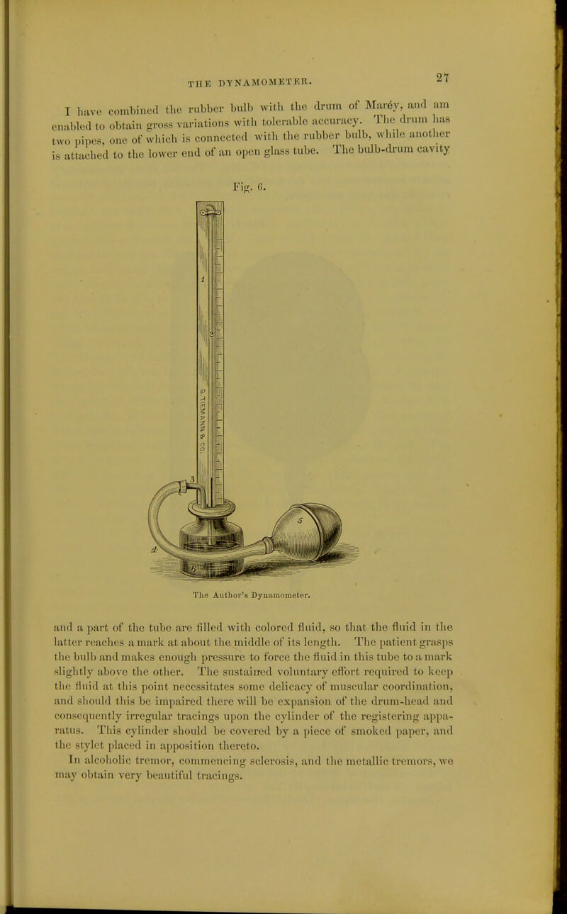 THE DYNAMOMETKR. 21 I have combined tlie rubber bulb Avith tlie drum of Mar6y, and am .abled to obtain gross variations Avith tolerable aceuracy. TI.e drum has 'o pipes, one of which is connected witli the rubber bulb, while another attached to the lower end of an open glass tube. The bulb-drura cavity The Author's Dynamometer. and a part of tlie tube are filled with colored fluid, so that the fluid in the latter reaches a mark at about the middle of its length. The patient grasps the bulb and makes enough pressure to force tiie fluid in this tube to a mark slightly above the other. The sustained voluntary effort required to keep the fluid at this point necessitates some delicacy of muscular coordination, and siiould this be impaired there will be expansion of the drum-head and consetpiently irregular tracings upon the cylinder of the registering appa- ratus. This cylinder should be covered by a piece of smoked paper, and tiie stylet placed in apposition thereto. In alcoholic tremor, commencing sclerosis, and the metallic tremors, we may obtain very beautiful tracings.