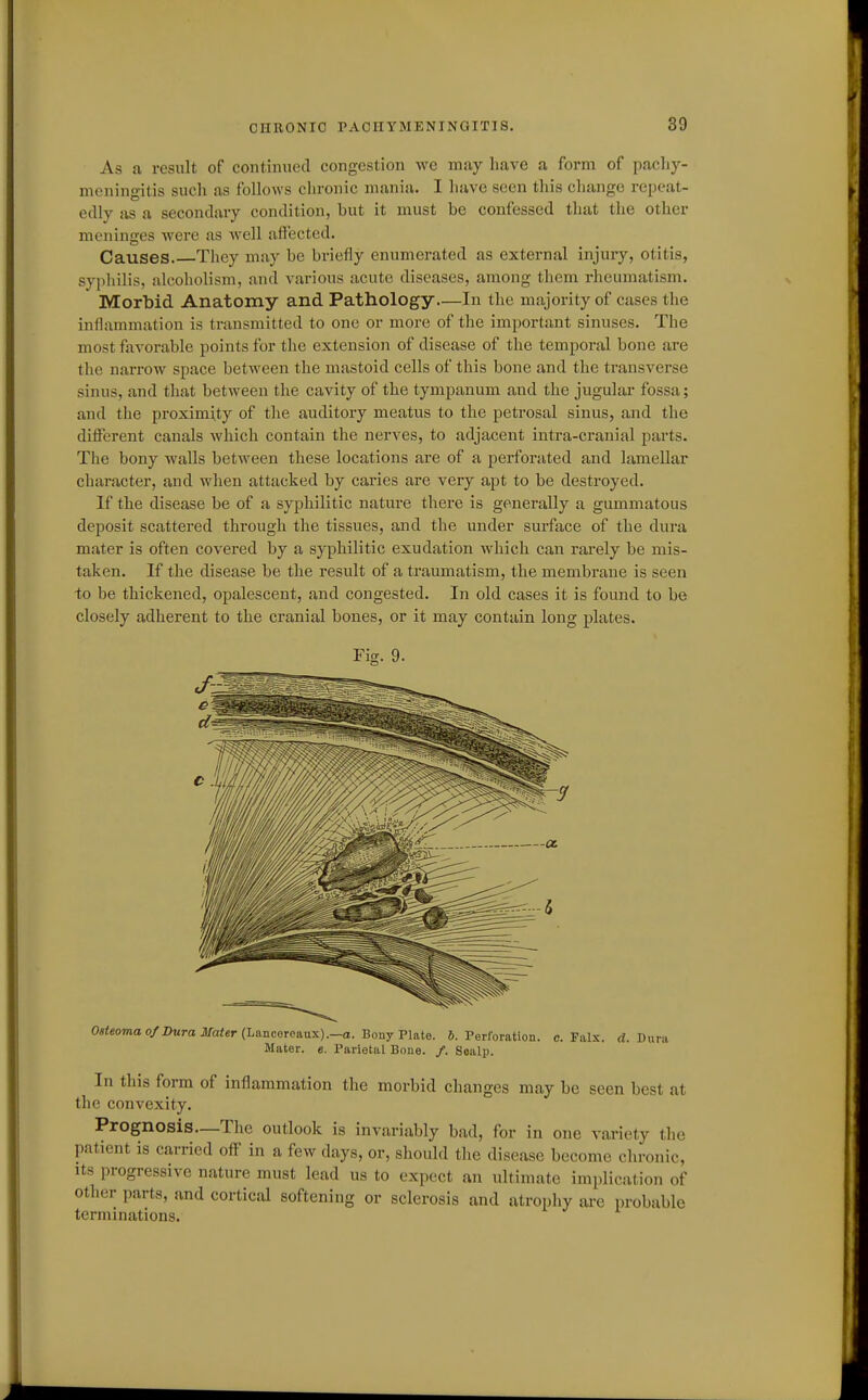 As a result of continued congestion we may have a form of pachy- meningitis sucli as follows chronic mania. I have seen this change repeat- edly as a secondary condition, but it must be confessed that the other meninges were as well affected. Causes.—Tliey may be briefly enumerated as external injury, otitis, syphilis, alcoholism, and various acute diseases, among them rheumatism. Morbid Anatomy and Pathology—In the majority of cases the inflammation is transmitted to one or more of the important sinuses. The most favorable points for the extension of disease of the temporal bone are the narrow space between the mastoid cells of this bone and the transverse sinus, and that between the cavity of the tympanum and the jugular fossa; and the proximity of the auditory meatus to the petrosal sinus, and the different canals which contain the nerves, to adjacent intra-cranial parts. The bony walls between these locations are of a perforated and lamellar character, and when attacked by caries are very apt to be destroyed. If the disease be of a syphilitic nature there is generally a gummatous deposit scattered through the tissues, and the under surface of the dura mater is often covered by a syphilitic exudation which can rarely be mis- taken. If the disease be the result of a traumatism, the membrane is seen -to be thickened, opalescent, and congested. In old cases it is found to be closely adherent to the cranial bones, or it may contain long plates. 0«<eomao/Z)«railfa<er(Lancorcaux).—a. Bony Plate. 6. Perforation, c. Fals. d. Dura Mater, e. Parietal Bone. /. Soalp. In this form of inflammation the morbid changes may be seen best at the convexity. Prognosis—The outlook is invariably bad, for in one variety the patient is carried off in a few days, or, should the disease become chronic, Its progressive nature must lead us to expect an ultimate implication of other parts, and cortical softening or sclerosis and atrophy ai-e probable terminations.