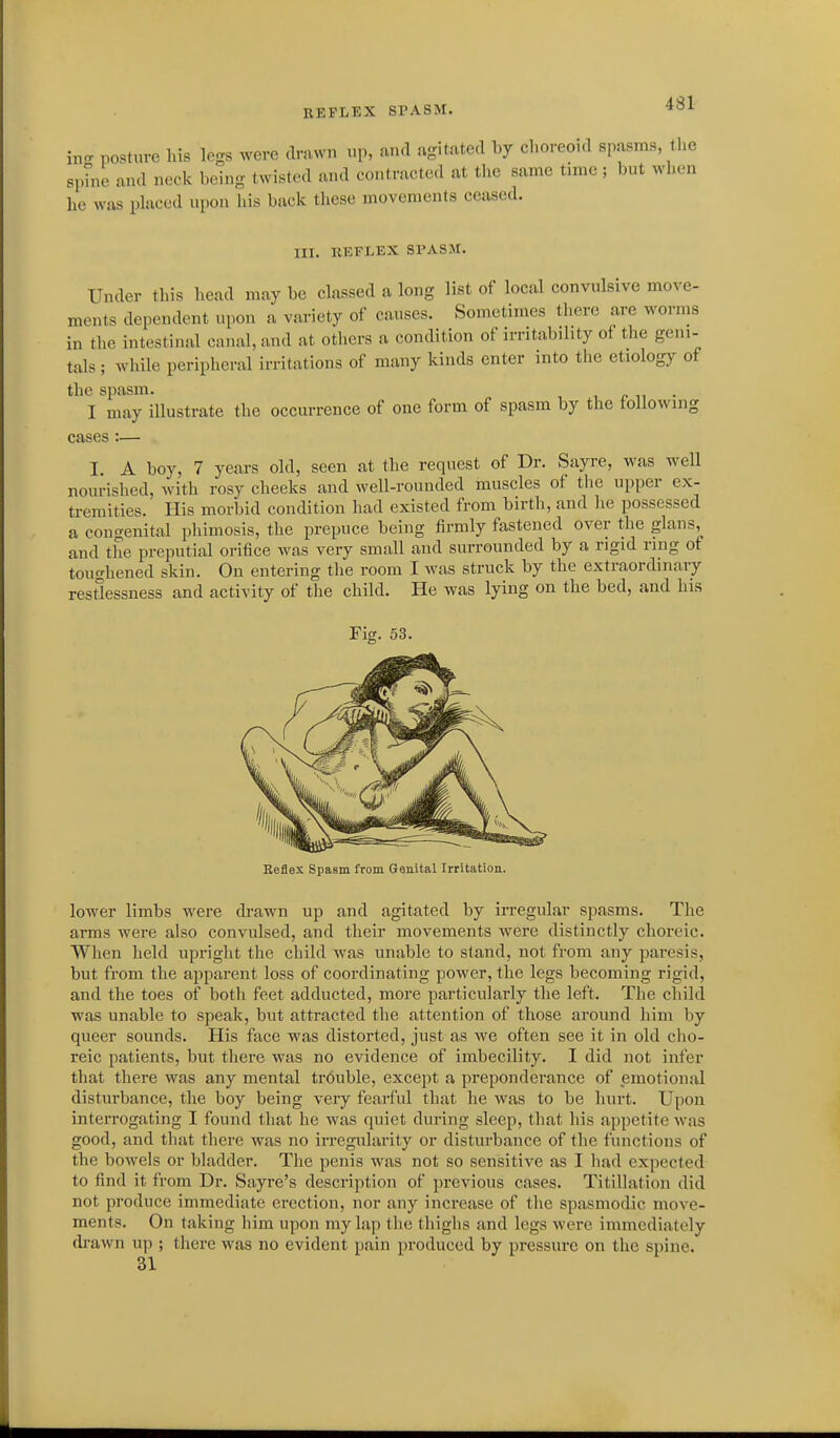 EEFIiEX SPASM. in- posture his legs were drawn up, and agitated by choreoid spasms, t sphie and neck being twisted and contracted at the same time; but wh- he was placed upon his back these movements ceased. III. KEFLEX SPASM. Under this head may be classed a long list of local convulsive move- ments dependent upon a variety of causes. Sometimes there are worms in the intestinal canal, and at others a condition of irritability of the geni- tals ; while peripheral irritations of many kinds enter into the etiology of the spasm. i n • I may illustrate the occurrence of one form of spasm by the following cases :— I. A boy, 7 years old, seen at the request of Dr. Sayre, was well nourished, with rosy cheeks and well-rounded muscles of the upper ex- tremities. His morbid condition had existed from birth, and lie possessed a congenital phimosis, the prepuce being firmly fastened over the glans, and tlie preputial orifice was very small and surrounded by a rigid ring of toughened skin. On entering the room I was struck by the extraordinary restlessness and activity of the child. He was lying on the bed, and his Beflex Spasm from Genital Irritation. lower limbs were drawn up and agitated by irregular spasms. The arms were also convulsed, and their movements were distinctly choreic. When held upright the child was unable to stand, not from any paresis, but from the apparent loss of coordinating power, the legs becoming rigid, and the toes of both feet adducted, more particularly the left. The child was unable to speak, but attracted the attention of those around him by queer sounds. His face was distorted, just as we often see it in old cho- reic patients, but there was no evidence of imbecility. I did not infer that there was any mental trbuble, except a preponderance of emotional disturbance, the boy being very fearful that he was to be hurt. Upon interrogating I found that he was quiet during sleep, that his appetite was good, and that there was no irregularity or disturbance of the functions of the bowels or bladder. The penis was not so sensitive as I had expected to find it from Dr. Sayre's description of previous cases. Titillatioii did not produce immediate erection, nor any increase of the spasmodic move- ments. On taking him upon my lap the thighs and legs were immediately di-awn up ; there was no evident pain produced by pressure on the spine. 31