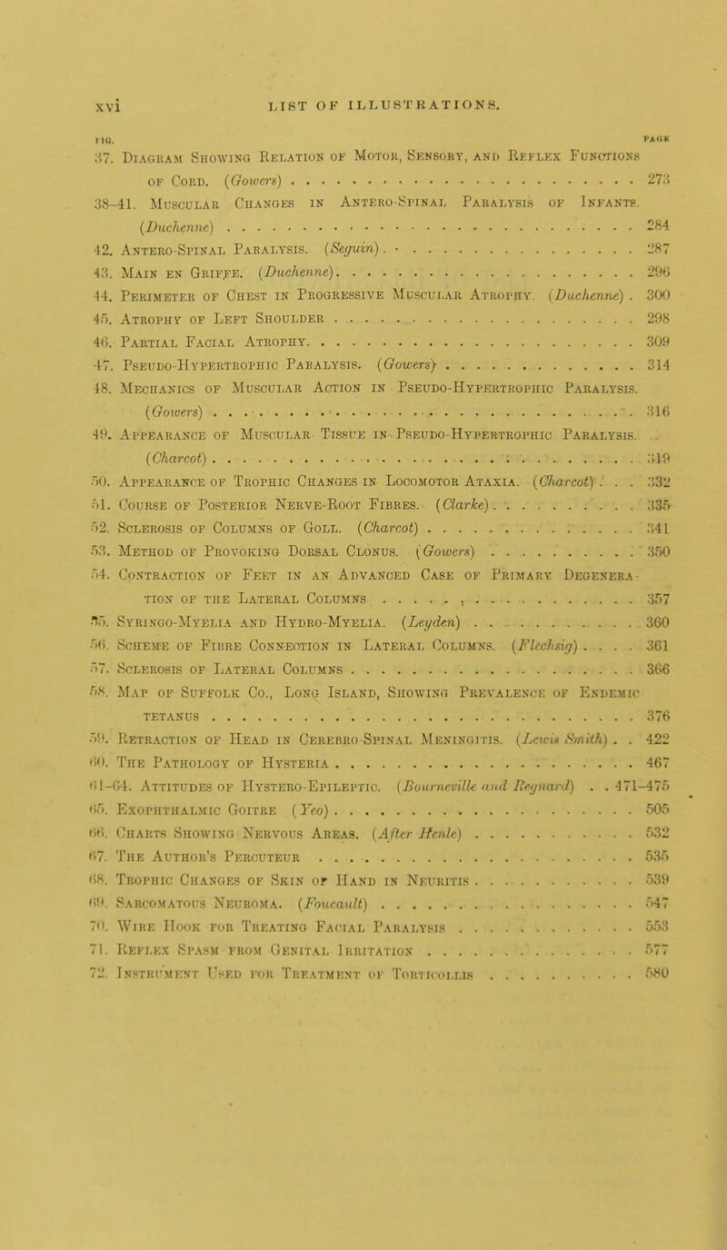 HQ. fAWK ;^7. DiAGUAM Showing Relation of Motok, Sensory, and Rkflex Functions OF Cord. (Gowcrs) 27.'-« 38-41. Muscular Changes in Antero-Si'inal Paralysis of Infants. {Biichenne) 284 ■12. Antero-Spinal Paralysis. (Seguin). • 1'87 43. Main en Grifj-e. (Duchenne) 296 44. Perimeter of Chest in Progressive JiluscuLAR Atrophy. (Duchenne) . 300 4.'j. Atrophy of Left Shoulder 298 4G. Partial Facial Atrophy 309 47. Pseudo-Hypertrophic Paralysis. (Gowers) 314 48. Mechanics of Muscular Action in Pseudo-Hypertrophic Paralysis. {Goivers) 316 49. Appearance of Muscular Ti!3.sirE in Pseudo-Hypertrophic Paralysis. .. (Charcot) ■)0. Appearance OF Trophic Changes in Locomotor Ataxia. (C/iarcot) . . . 332 .■)!. Course of Posterior Nerve-Root Fibres. [Clarke) 335 H2. Sclerosis of Columns of Goll. (Charcot) 341 53. Method of Provoking Dorsal Clonus. (Gowcrs) 350 54. Contraction of Feet in an Advanced Case of Primary Degenera- tion of the Lateral Columns ; 357 •To. Syringo-Myelia and Hydro-Myelia. (Leyden) 360 56. Scheme of Fibre Conneotion in Lateral Columns. (Flechsig) .... 361 57. Sclerosis of Lateral Columns 366 5.S. Map of Suffolk Co., Long Island, Showing Prevalence of Endemic tetanus 376 59. Retraction of Head in Cerebro spinal Meningitis. (LewU i^nnth) . . 422 60. The Pathology of Hysteria 467 61-64. Attitudes of Hystero-Epileptic. (BournevUle aiid lieijnard) . .471-475 65. Exophthalmic Goitre (Yeo) 505 66. Charts Showing Nervous Areas. (After Jfenlc) 532 67. The Author's Percuteur 535 68. Trophic Changes of Skin or Hand in Neuritis 539 69. Sarcomatous Neuroma. (Foucault) 547 7<t. Wire Hook for Treating Facial Paralysis 553 71. Reflex Spasm from Genital Irritation 577 72. Instrument Used for Treatment ok Torticollis 580