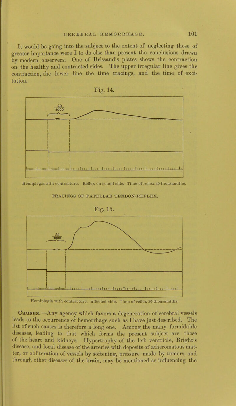 It would be going into the subject to the extent of neglecting those of greater importance were I to do else than present the conclusions drawn by modern observers. One of Brissaud's plates shows the contraction on the healthy and contracted sides. The upper irregular line gives the contraction, the lower line the time tracings, and the time of exci- tation. Fig. 14. 40 I I I I I I iMiriiiiiliiririiiiiririiiiiiliMiiiMii! I I I I i I I I I ll I I I I I 1 1 1 I I 1 I I I I I I I I I I I I I I I I I I I I I I I I I I I I I Hemiplegia with contracture. Reflex on sound side. Time of reflex 40-thousandths. TRACINGS OF PATELLAR TENDON-REFLEX. Fig. 15. 36 / 1000 / N. 1 M n 1 (III 1 iiiini llflMlll'.llMll ll 1 1 1 1111 1 1 1 I 11 11 1 1 1 1 I 1 11, TiI 1 1 11 11 1 11 1 1 1 11 1 1 1 1 1 11 1 1 1 1 Hemiplegia with contracture. Affected side. Time of reflex 36-thousandths. Causes.—Any agency which favors a degeneration of cerebral vessels leads to the occurrence of hemorrhage such as I have just described. The list of such causes is therefore a long one. Among the many formidable diseases, leading to that which forms the present subject are those of the heart and kidneys. Hypertrophy of the left ventricle, Bright's disease, and local disease of the arteries with deposits of atheromatous mat- ter, or obliteration of vessels by softening, pressure made by tumors, and through other diseases of the brain, may be mentioned as influencing the