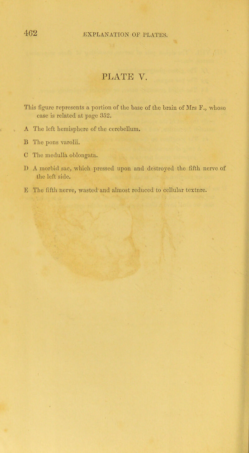 402 PLATE V. This figure represents a portion of the base of the brain of Mrs F., whose case is related at page 352. A The left hemisphere of the cerebellum. B The pons varolii. C The medulla oblongata. I) A morbid sac, which pressed upon and destroyed the fifth nerve of the left side. E The fifth nerve, wasted'and almost reduced to cellular texture.