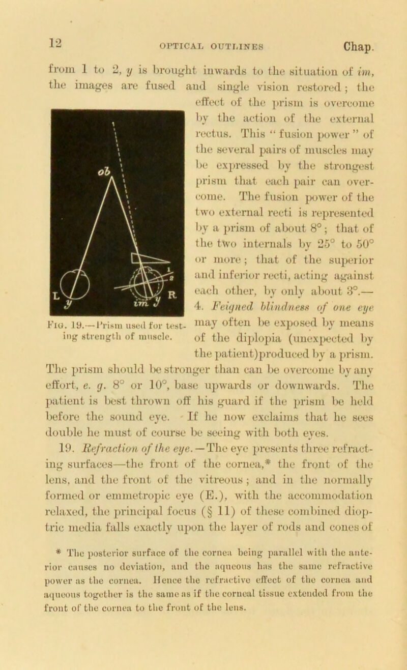 from 1 to 2, y is broiij^ht inwards to the situation of im, the images are fused and single vision restored; the 1‘ffeet of the prism is overcome by the action of the extcumal rectus. This “ fusion power ” of the several pairs of muscles may be expressed by the strongest [)rism that each pair can over- come. The fusion power of the two external recti is represented I>y a ])rism of alx)ut 8°; that of the two internals l>y 25° to 50° or more; that of the supeiior and infei'ior recti, acting against each other, by only about 3°.— 4. Feigned hlindnestf of one eye Fio. iy.—I'risiu usoil for tfst- often be exposed by means ing strtMigih of iniisclc. of the dii)lopia (unexpected by the j«itlent)produced l>y a prism. The prism should Ikj stronger than can be overcome by any effort, e. g. 8° or 10°, base upwards or downwards. The patient is l)est thrown oft' his guard if the i)rism l>e held before the sound eye. ' If he now exclaims that he sees double he must of course be seeiim with both eves. 10. liefradion of the eye. —The eye presents three refract- ing surfaces—the front of the cornea,* the front of the lens, and the front of the vitreous ; and in the normally formed or emmetro2)ic eye (E.), with the accommodation relaxed, the jirincijjal focus (§ 11) of these combined diop- tric media falls exactly uj)on the layer of rods and cones of * Tlio posterior surfucc of the coriieu being purullel with the ante- rior causes no deviation, and the aqneous has tlie same refractive power as tlie cornea. Hence the refractive effect of tlie cornea and aiiueoHS togetlier is the same as if tlie corneal tissue extended from the front of the cornea to the front of the lens.