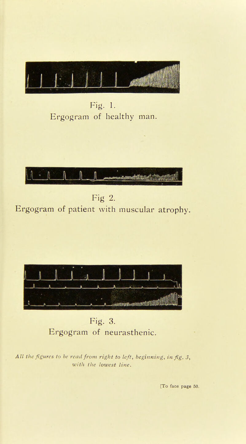 Fig. 1. Ergogram of healthy man. Fig 2. Ergogram of patient with muscular atrophy. Fig. 3. Ergogram of neurasthenic. All the figures to be read from right to left, beginning, in fig. 3, with the lowest line. [To face page 50.