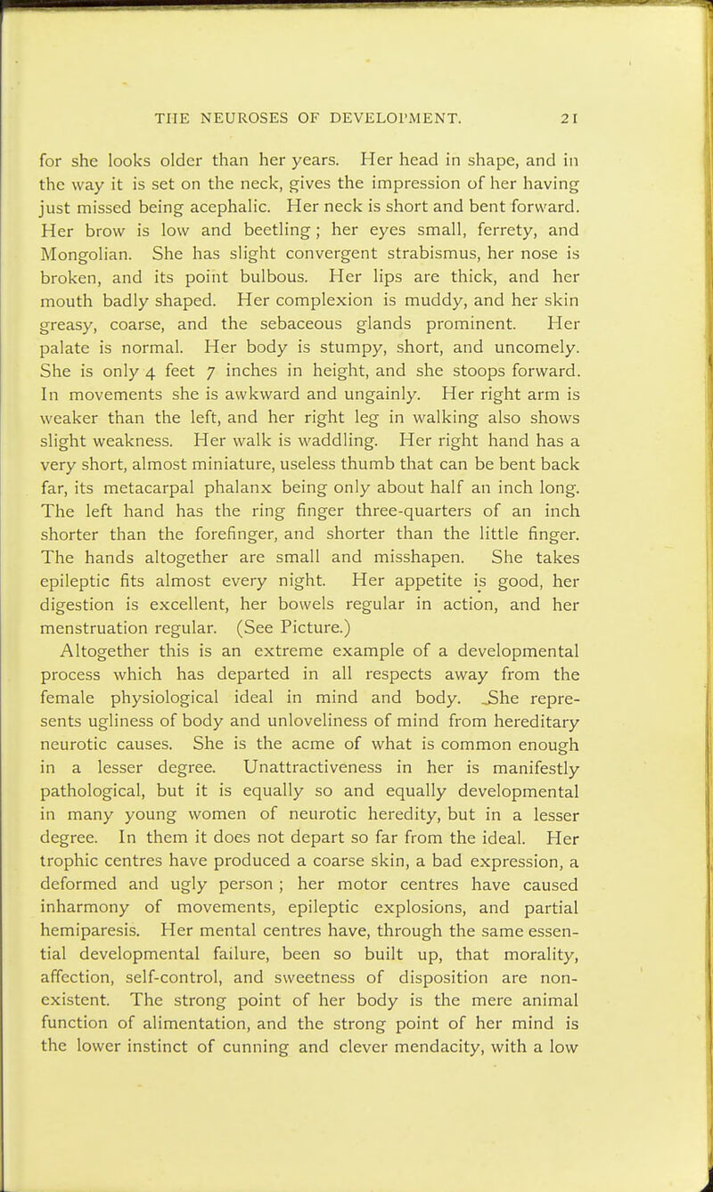 for she looks older than her years. Her head in shape, and in the way it is set on the neck, gives the impression of her having just missed being acephalic. Her neck is short and bent forward. Her brow is low and beetling; her eyes small, ferrety, and Mongolian. She has slight convergent strabismus, her nose is broken, and its point bulbous. Her lips are thick, and her mouth badly shaped. Her complexion is muddy, and her skin greasy, coarse, and the sebaceous glands prominent. Her palate is normal. Her body is stumpy, short, and uncomely. She is only 4 feet 7 inches in height, and she stoops forward. In movements she is awkward and ungainly. Her right arm is weaker than the left, and her right leg in walking also shows slight weakness. Her walk is waddling. Her right hand has a very short, almost miniature, useless thumb that can be bent back far, its metacarpal phalanx being only about half an inch long. The left hand has the ring finger three-quarters of an inch shorter than the forefinger, and shorter than the little finger. The hands altogether are small and misshapen. She takes epileptic fits almost every night. Her appetite is good, her digestion is excellent, her bowels regular in action, and her menstruation regular. (See Picture.) Altogether this is an extreme example of a developmental process which has departed in all respects away from the female physiological ideal in mind and body. J5he repre- sents ugliness of body and unloveliness of mind from hereditary neurotic causes. She is the acme of what is common enough in a lesser degree. Unattractiveness in her is manifestly pathological, but it is equally so and equally developmental in many young women of neurotic heredity, but in a lesser degree. In them it does not depart so far from the ideal. Her trophic centres have produced a coarse skin, a bad expression, a deformed and ugly person ; her motor centres have caused inharmony of movements, epileptic explosions, and partial hemiparesis. Her mental centres have, through the same essen- tial developmental failure, been so built up, that morality, affection, self-control, and sweetness of disposition are non- existent. The strong point of her body is the mere animal function of alimentation, and the strong point of her mind is the lower instinct of cunning and clever mendacity, with a low